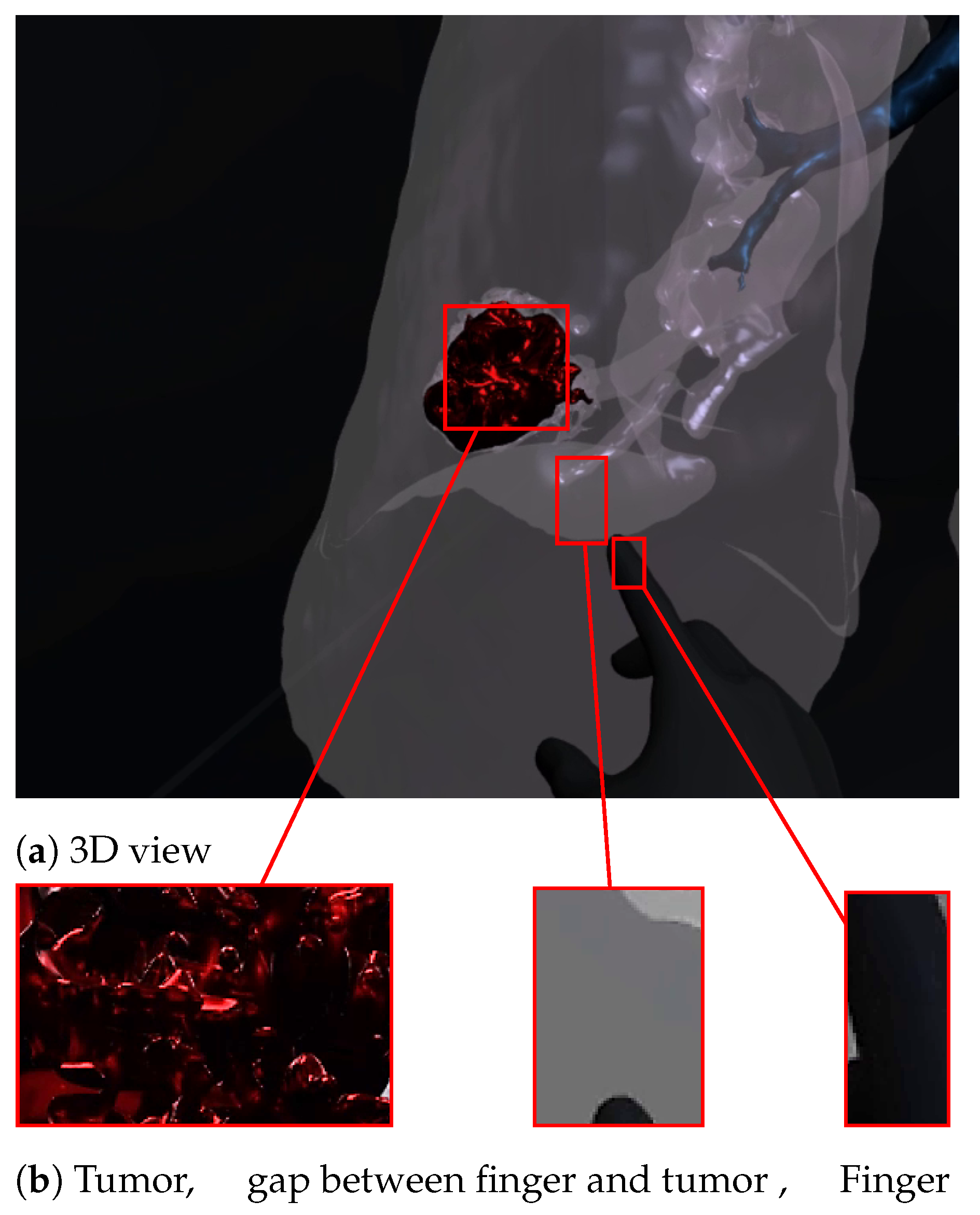 Diagnostics 13 00567 g007 Diagnostics 13 00567 g007