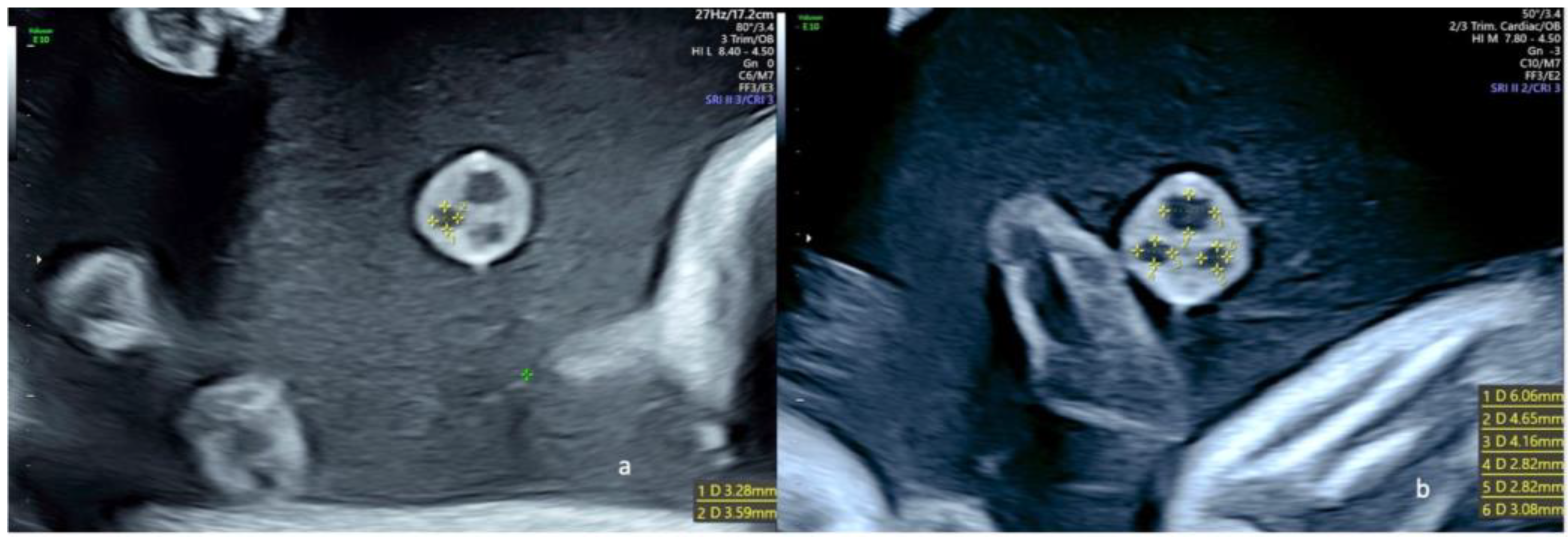 Diagnostics 13 00571 g003 550