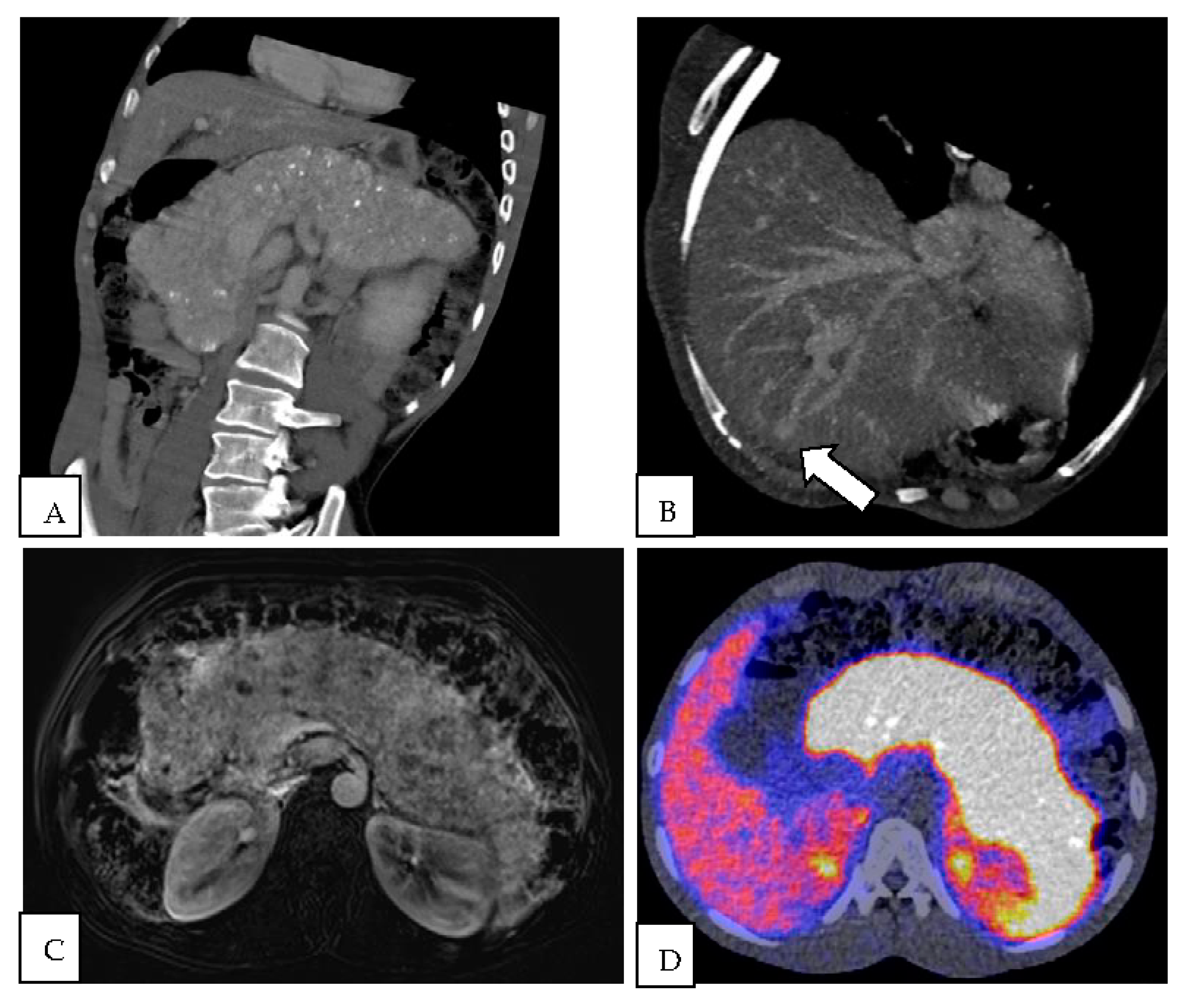 Diagnostics 13 00572 g001 Diagnostics 13 00572 g001
