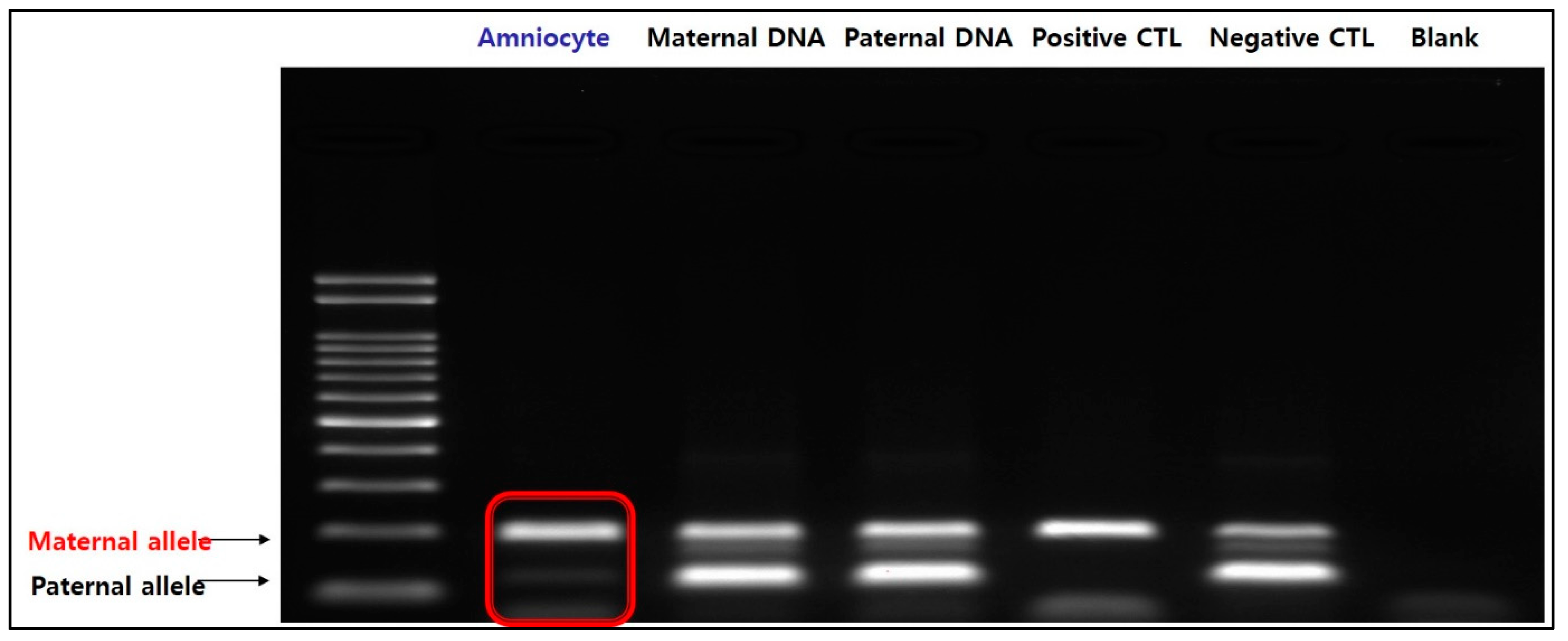 Diagnostics 13 00580 g005 Diagnostics 13 00580 g005