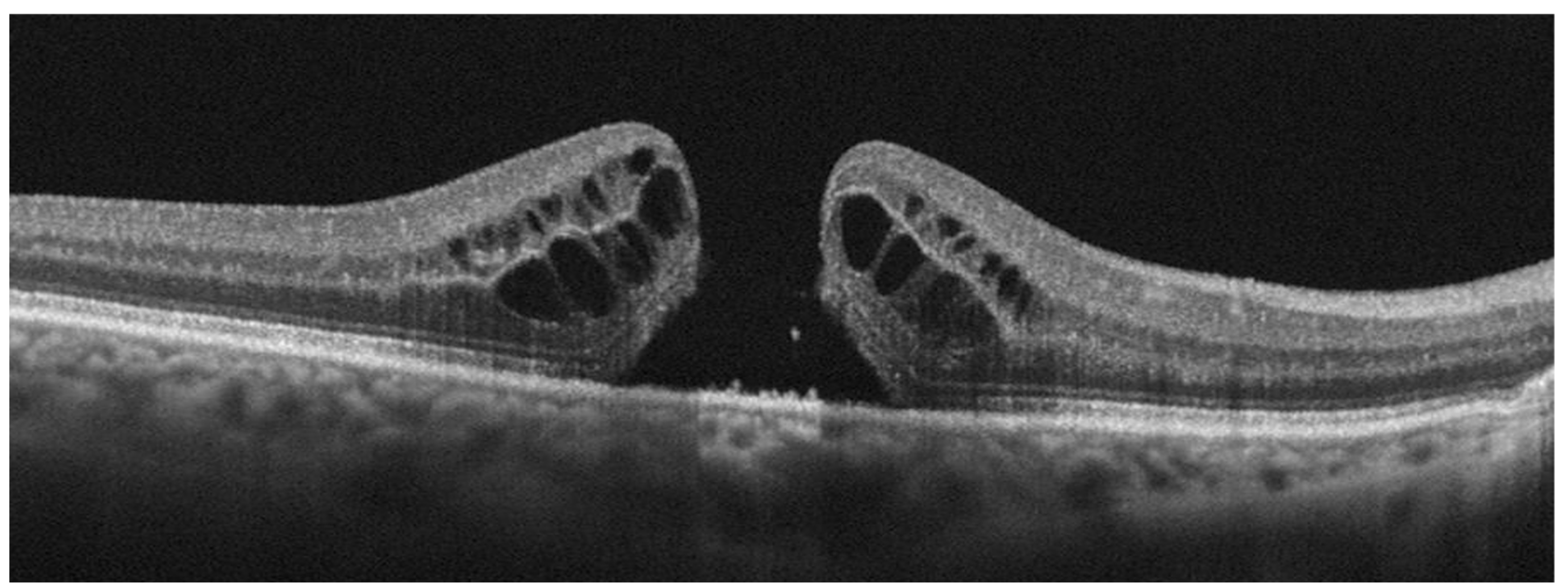 Diagnostics 13 00589 g003 Diagnostics 13 00589 g003