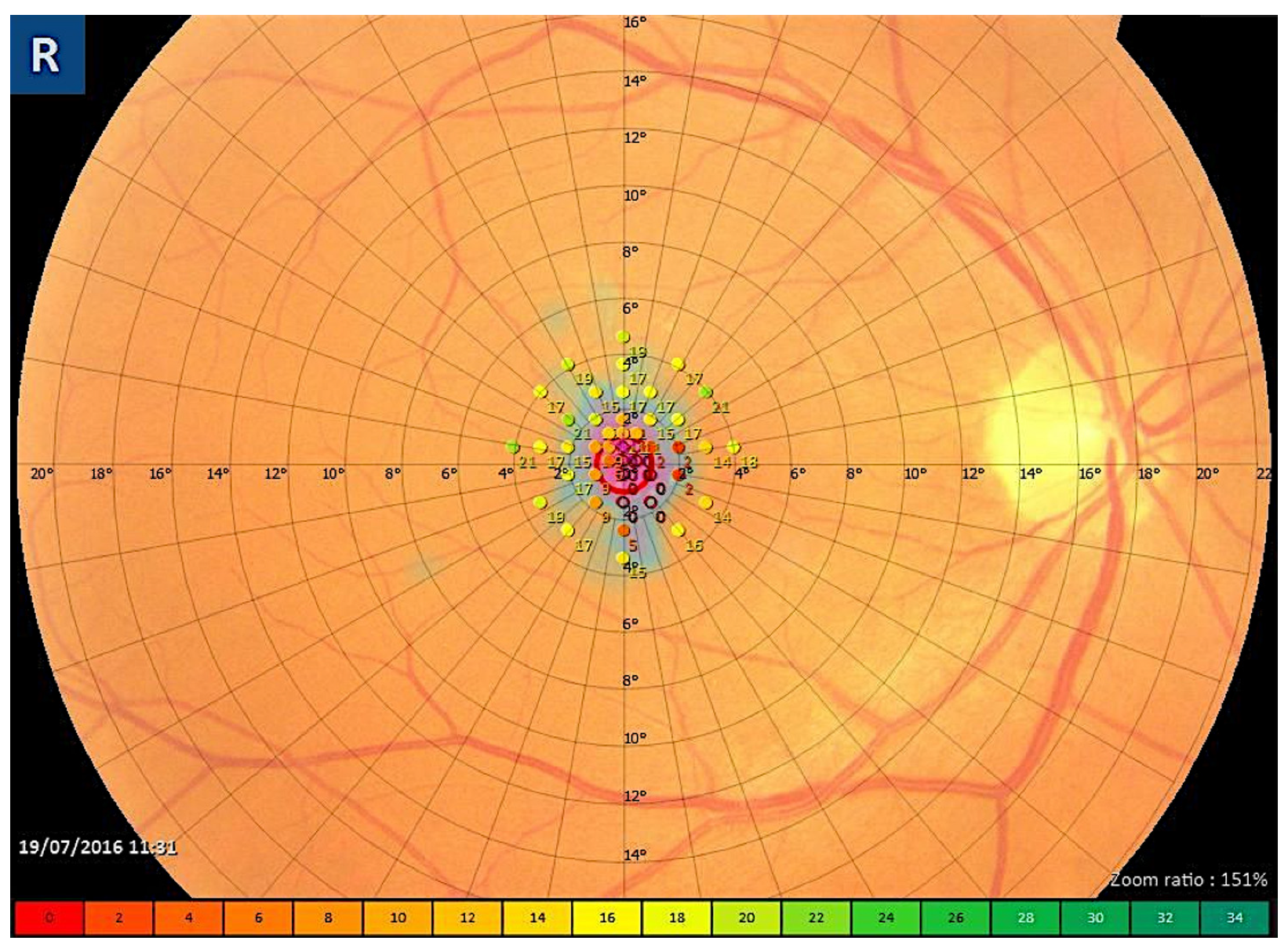 Diagnostics 13 00589 g006 Diagnostics 13 00589 g006
