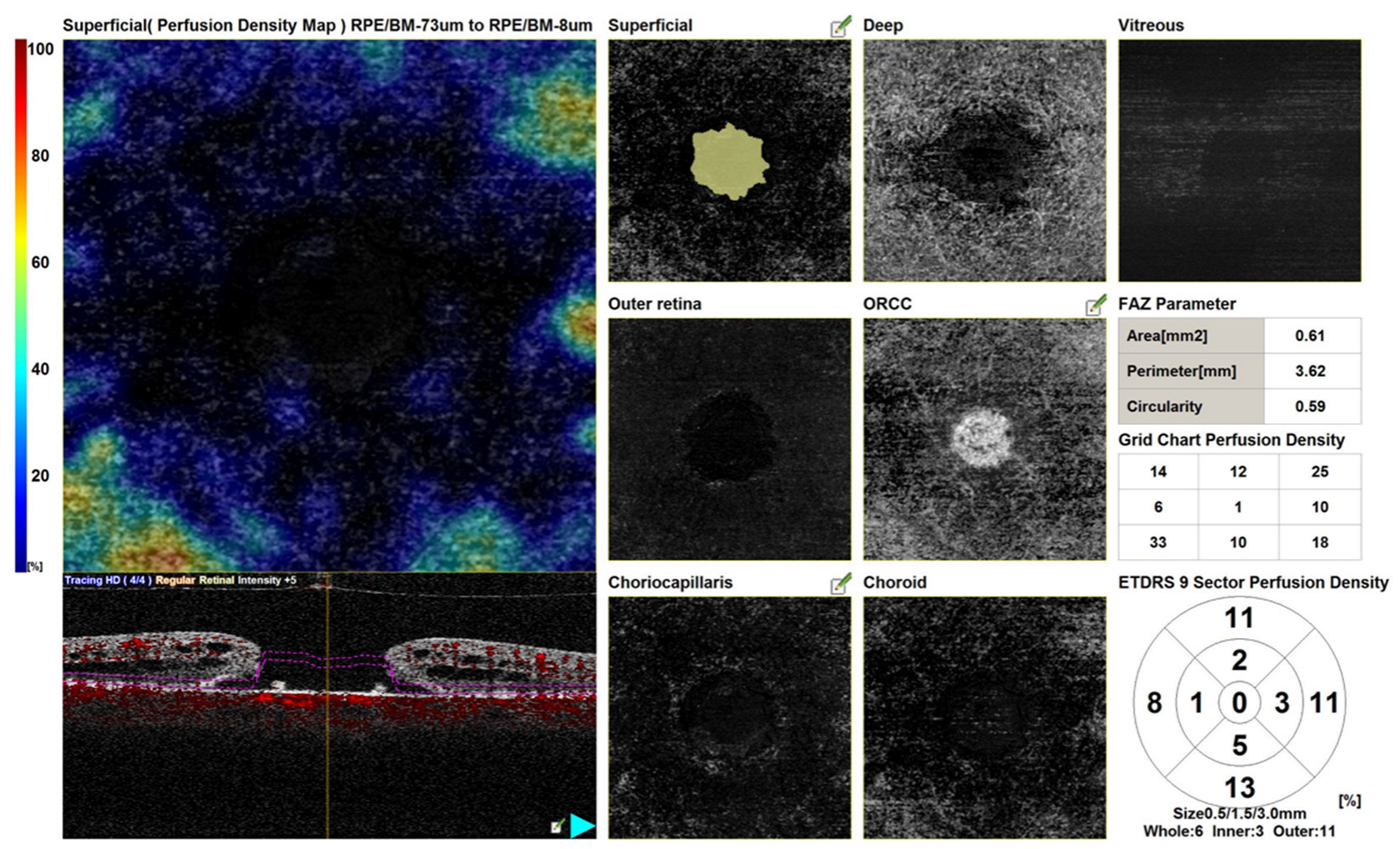 Diagnostics 13 00589 g007 Diagnostics 13 00589 g007