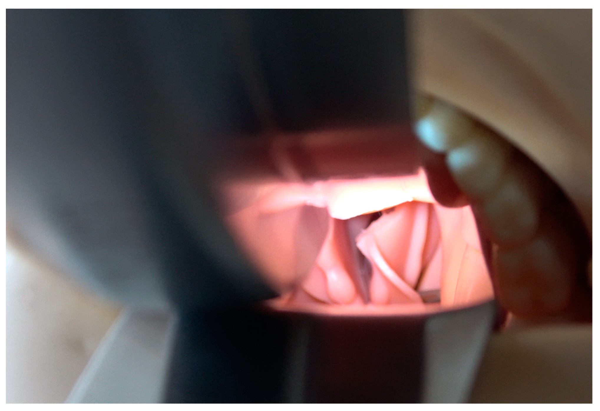 Diagnostics 13 00594 g008 Diagnostics 13 00594 g008