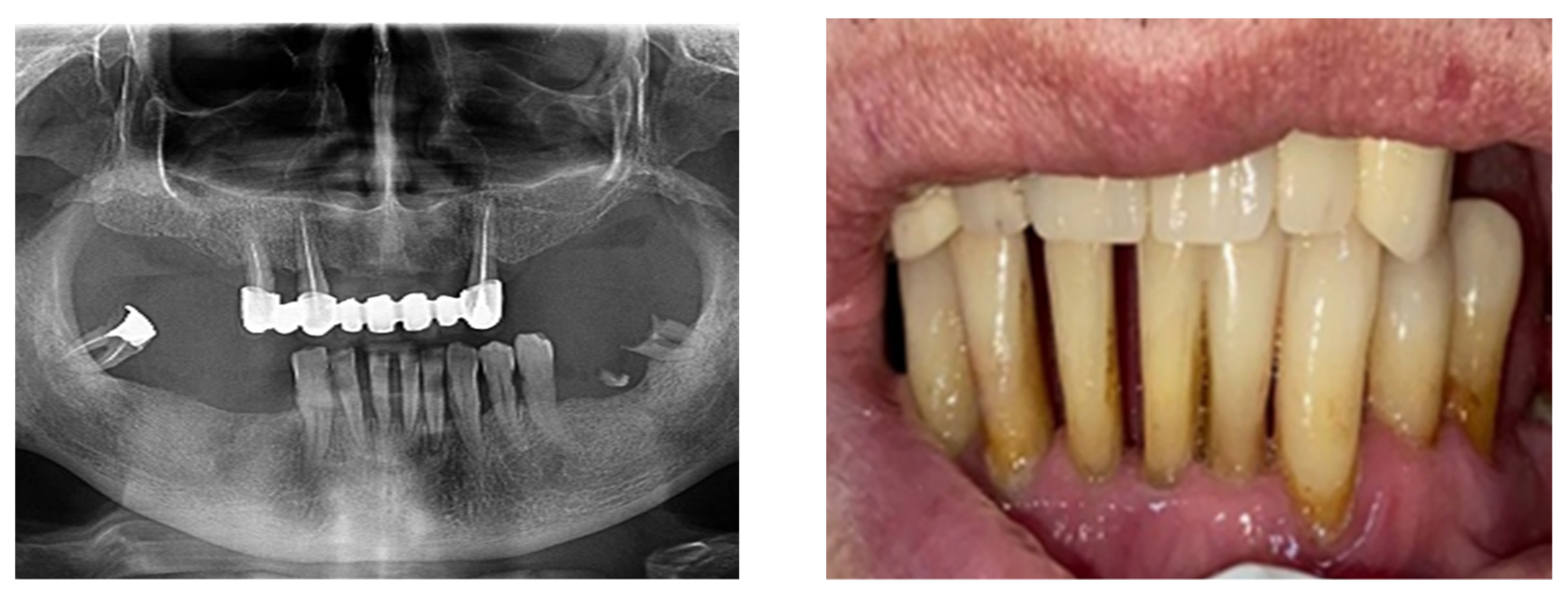 Diagnostics Free FullText Research Regarding Dental Mobility Phenomena in the Clinical