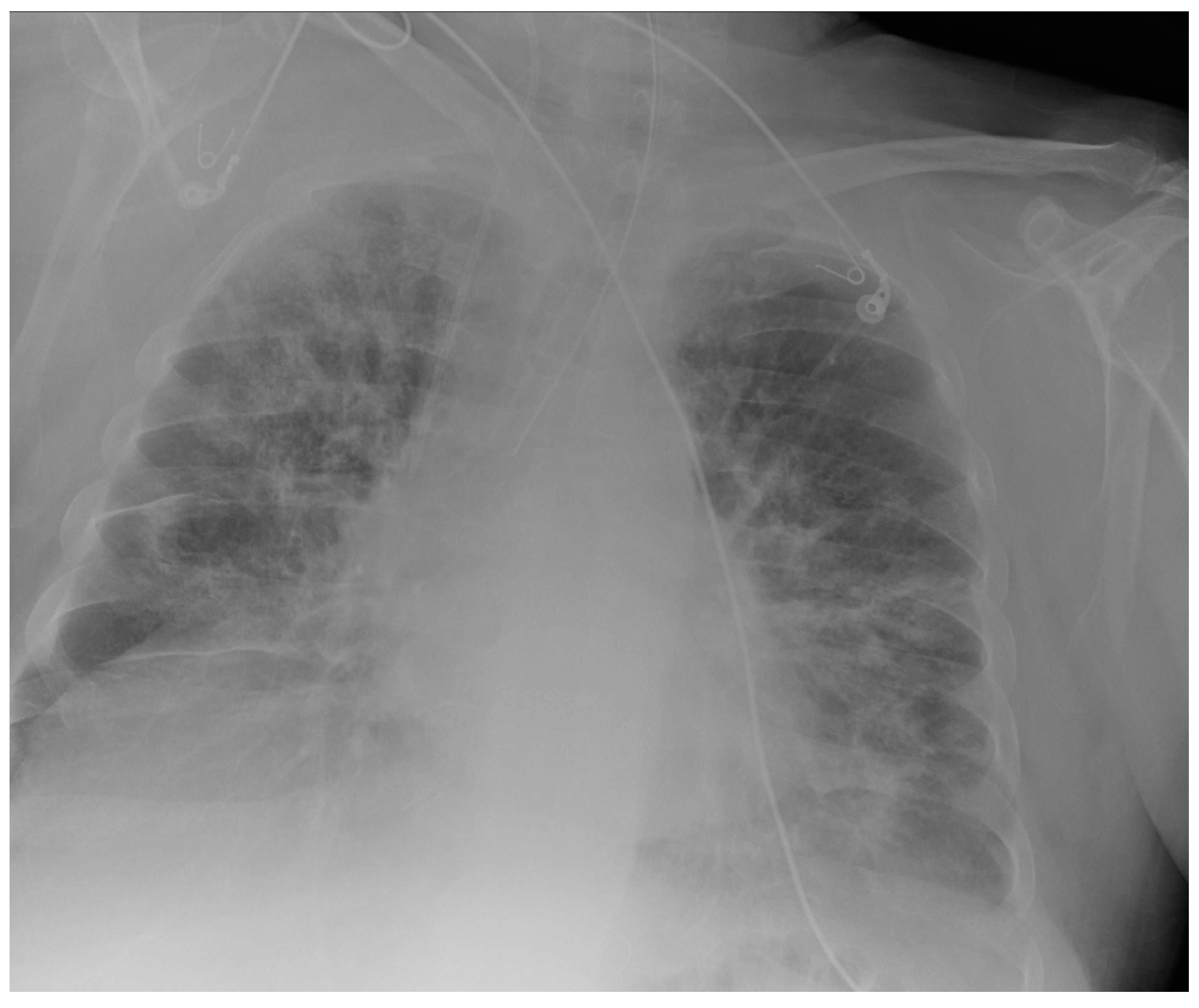 Diagnostics 13 00599 g011 Diagnostics 13 00599 g011