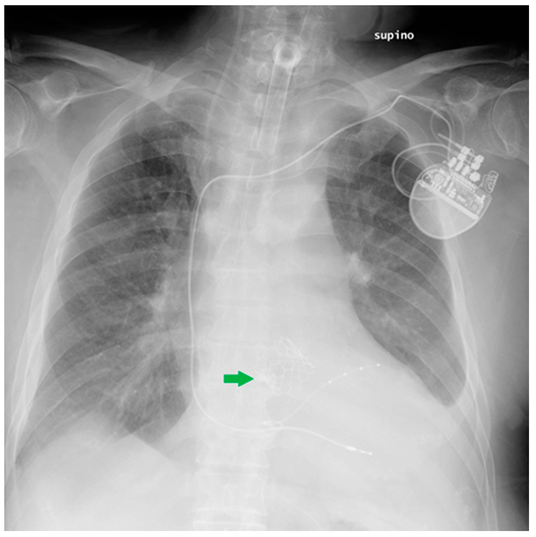 Diagnostics 13 00599 g018 Diagnostics 13 00599 g018