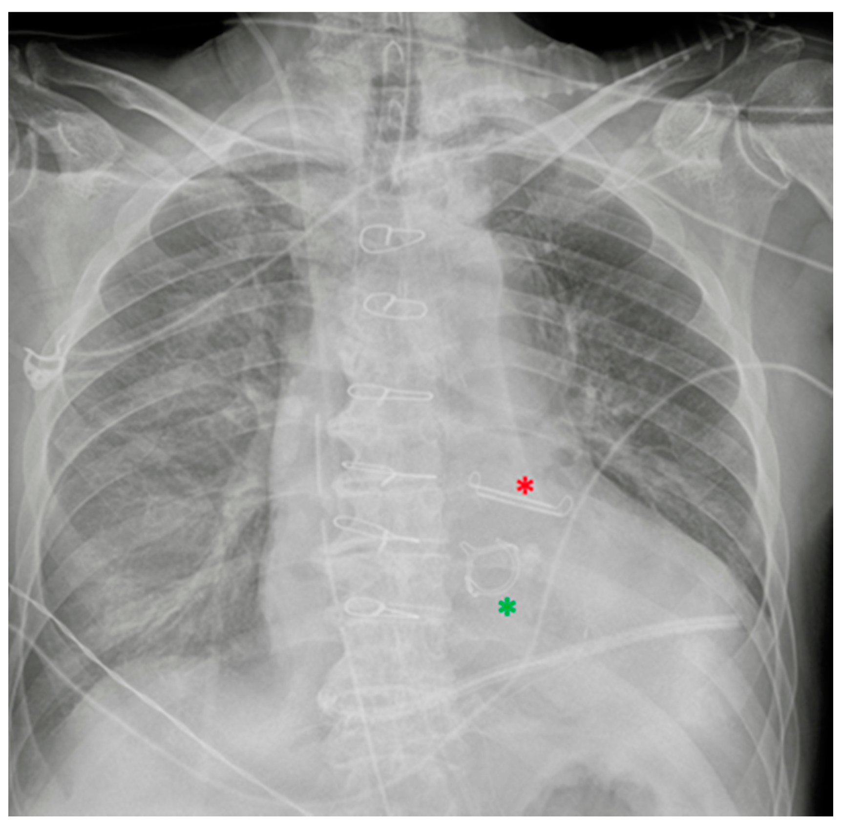 Diagnostics 13 00599 g020 Diagnostics 13 00599 g020