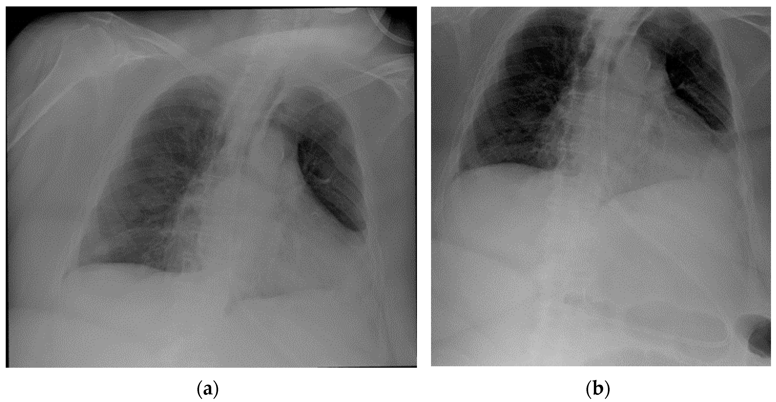 Diagnostics 13 00599 g023 Diagnostics 13 00599 g023