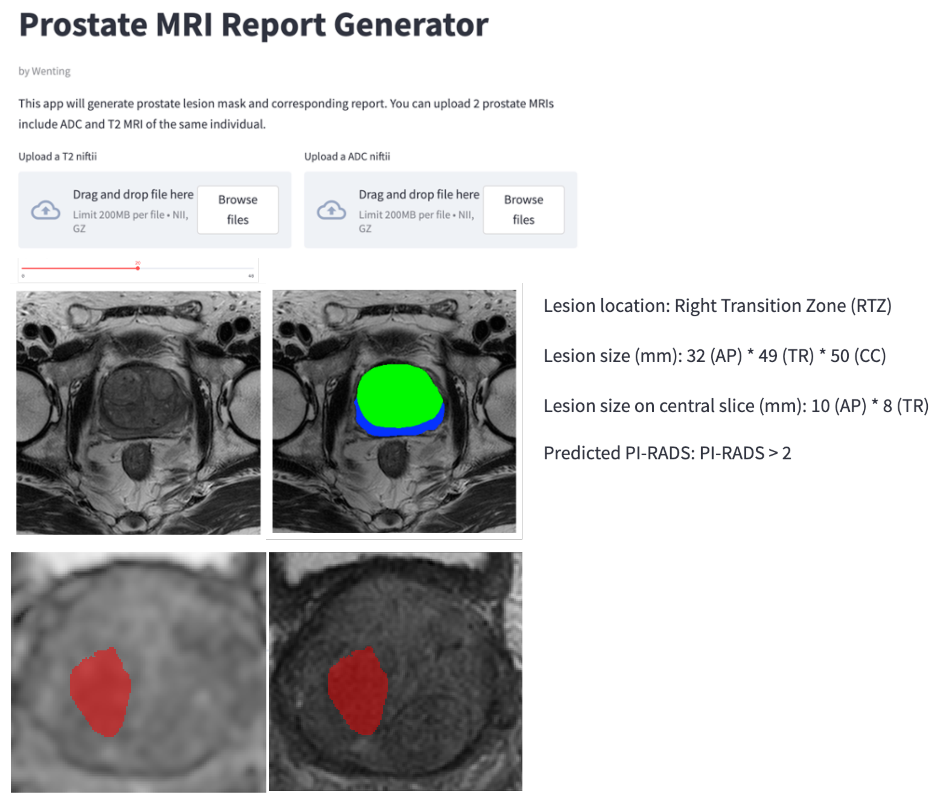 Diagnostics Free Full Text Joint Cancer Segmentation And PI RADS