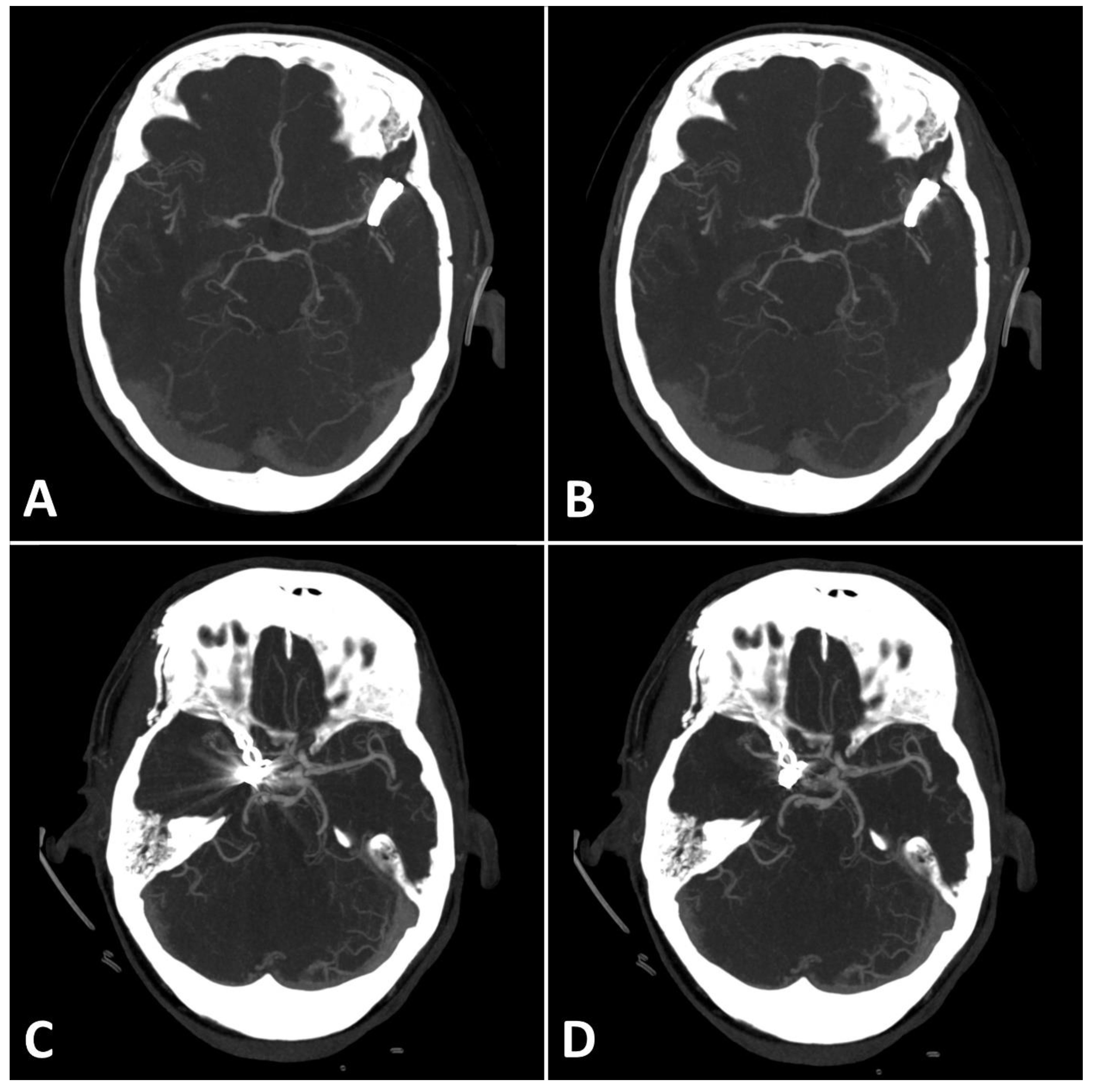 Diagnostics 13 00620 g004 Diagnostics 13 00620 g004