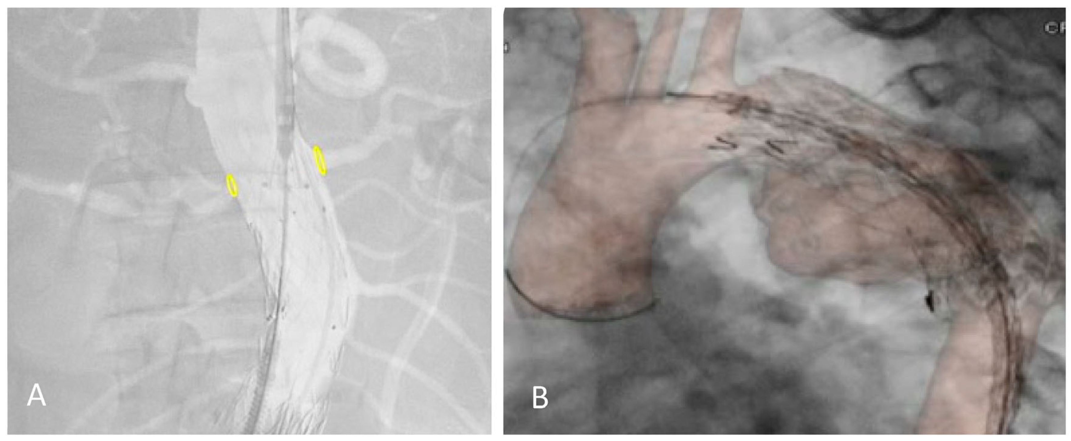 Diagnostics 13 00635 g001