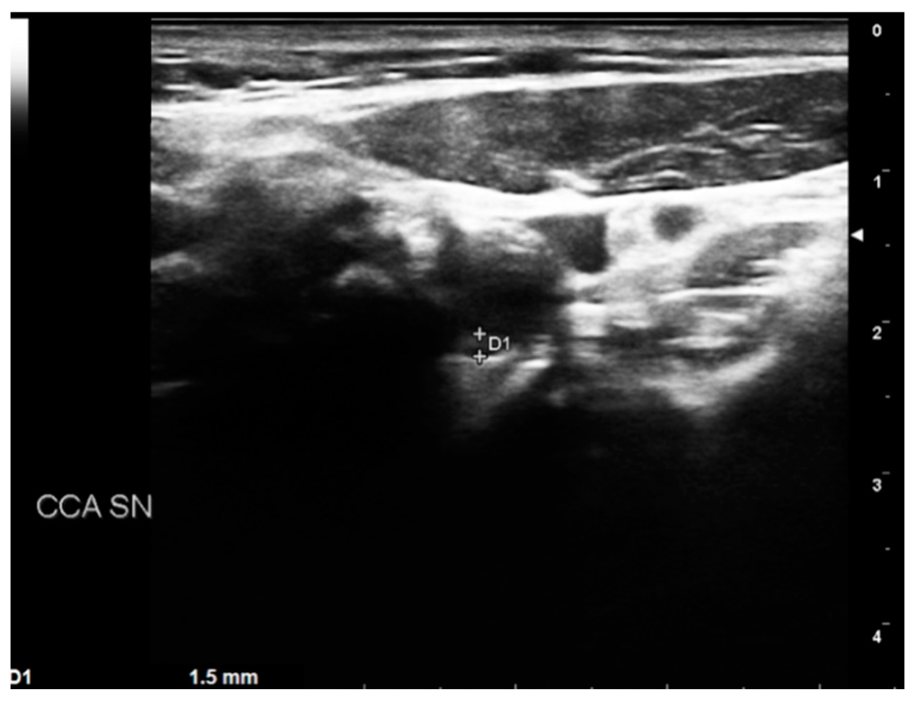 Diagnostics 13 00644 g004