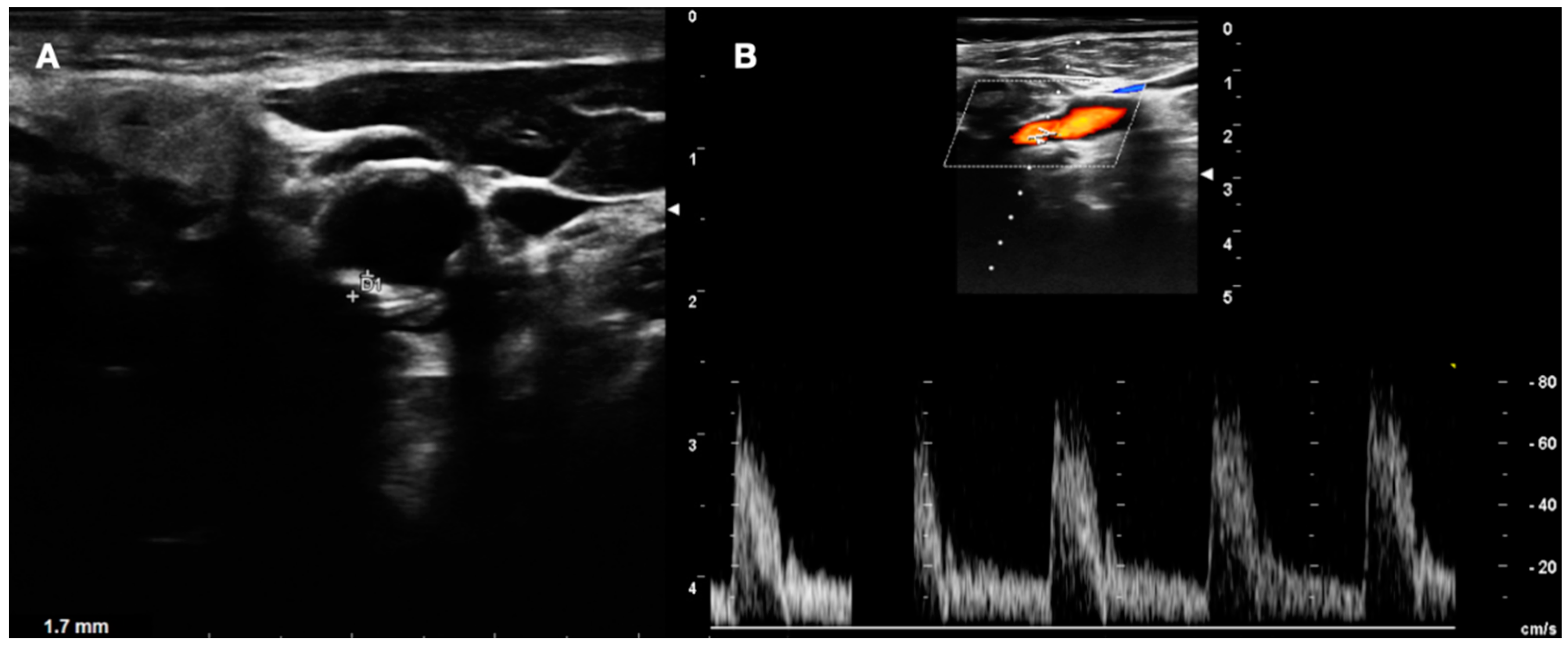 Diagnostics 13 00644 g005