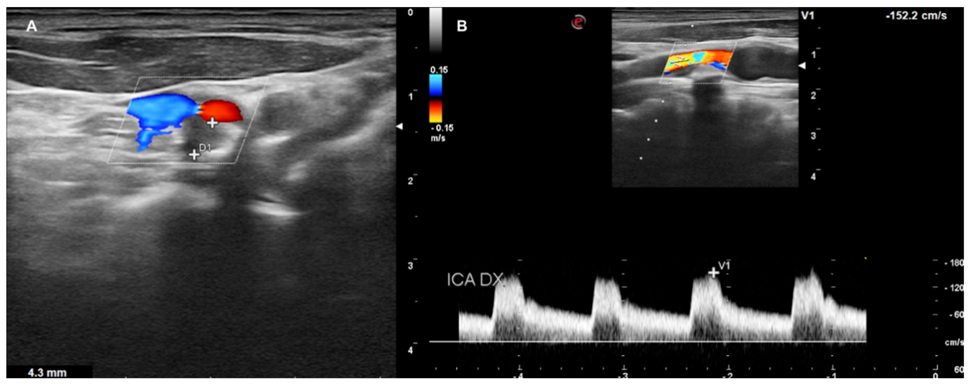 Diagnostics 13 00644 g007