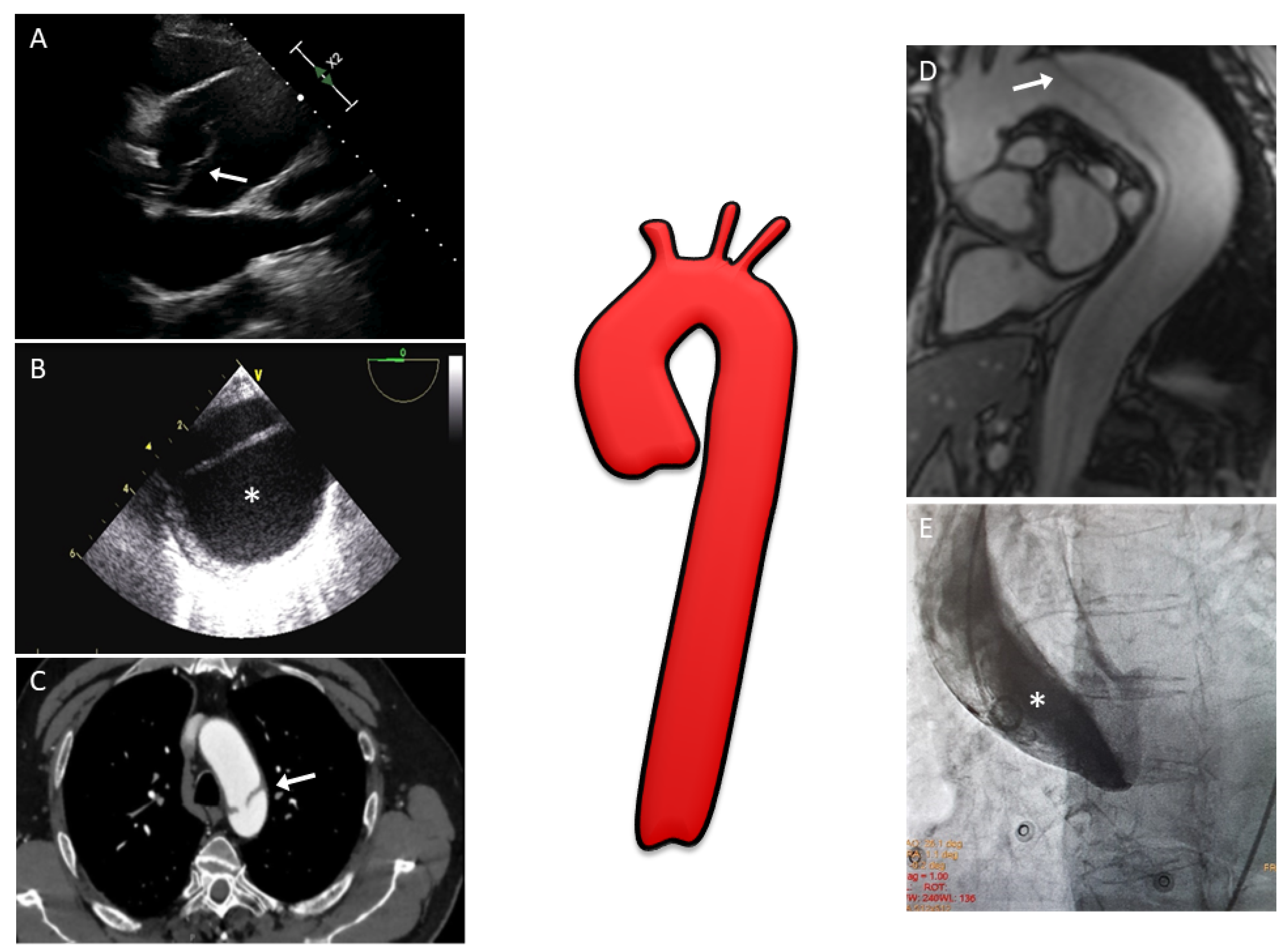 Diagnostics Free FullText The Role of Multimodality Imaging