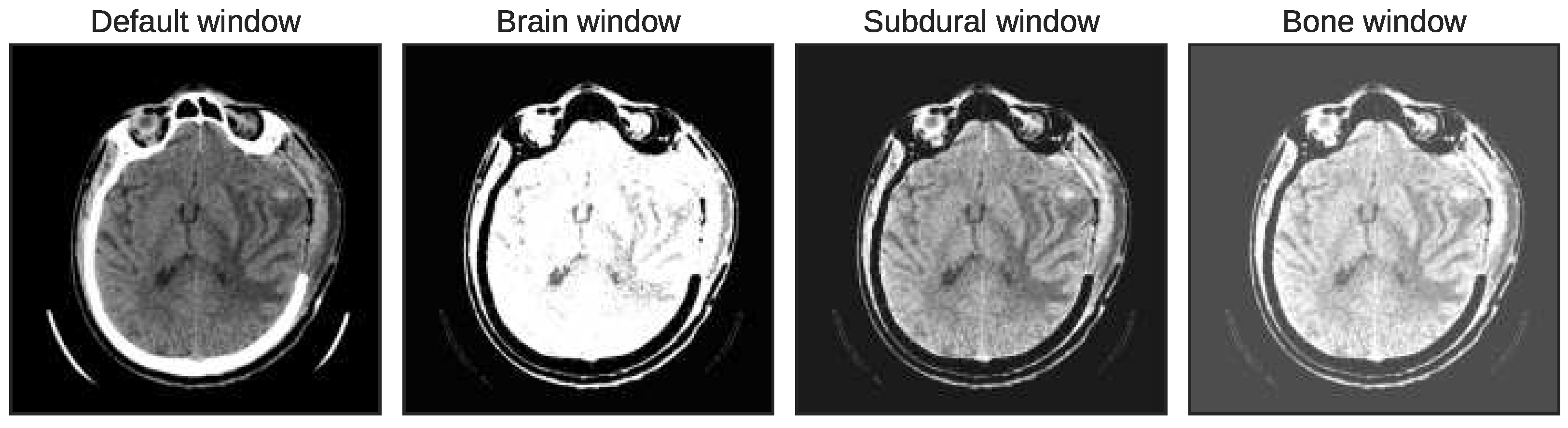 Diagnostics 13 00652 g004