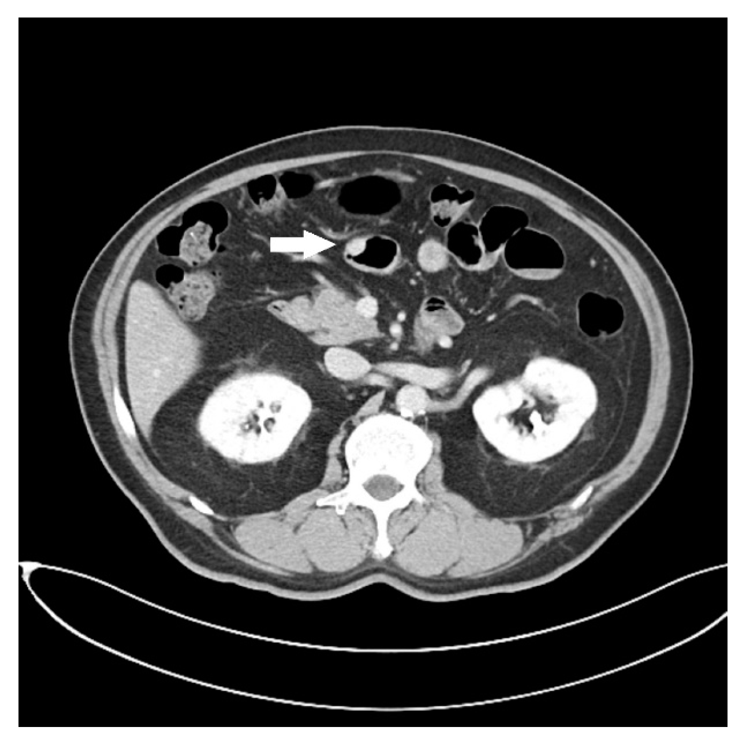 Diagnostics 13 00660 g001 550