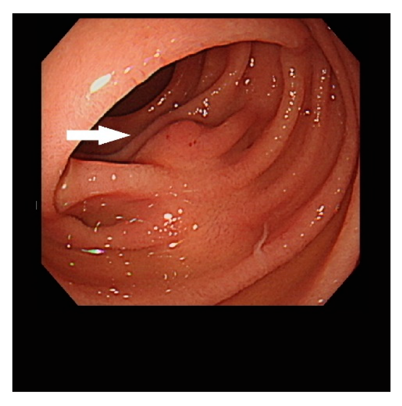 Diagnostics 13 00660 g002 550