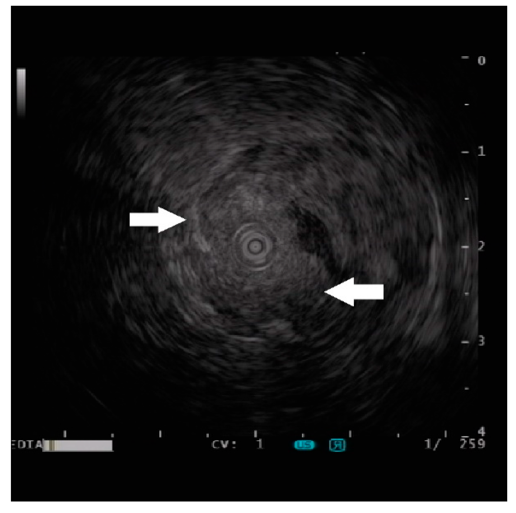 Diagnostics 13 00660 g003 550