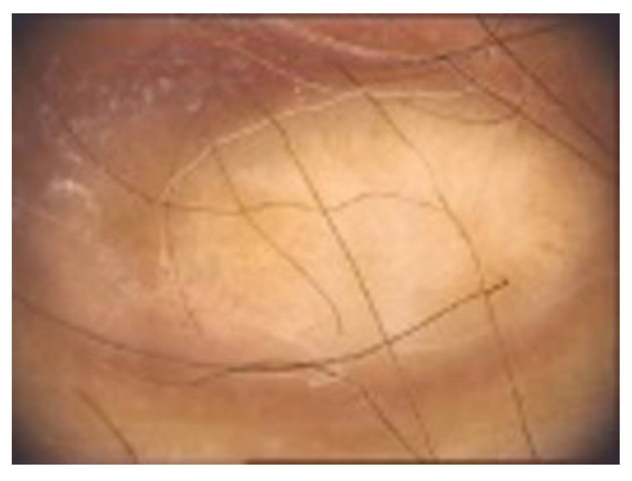 Diagnostics 13 00671 g013