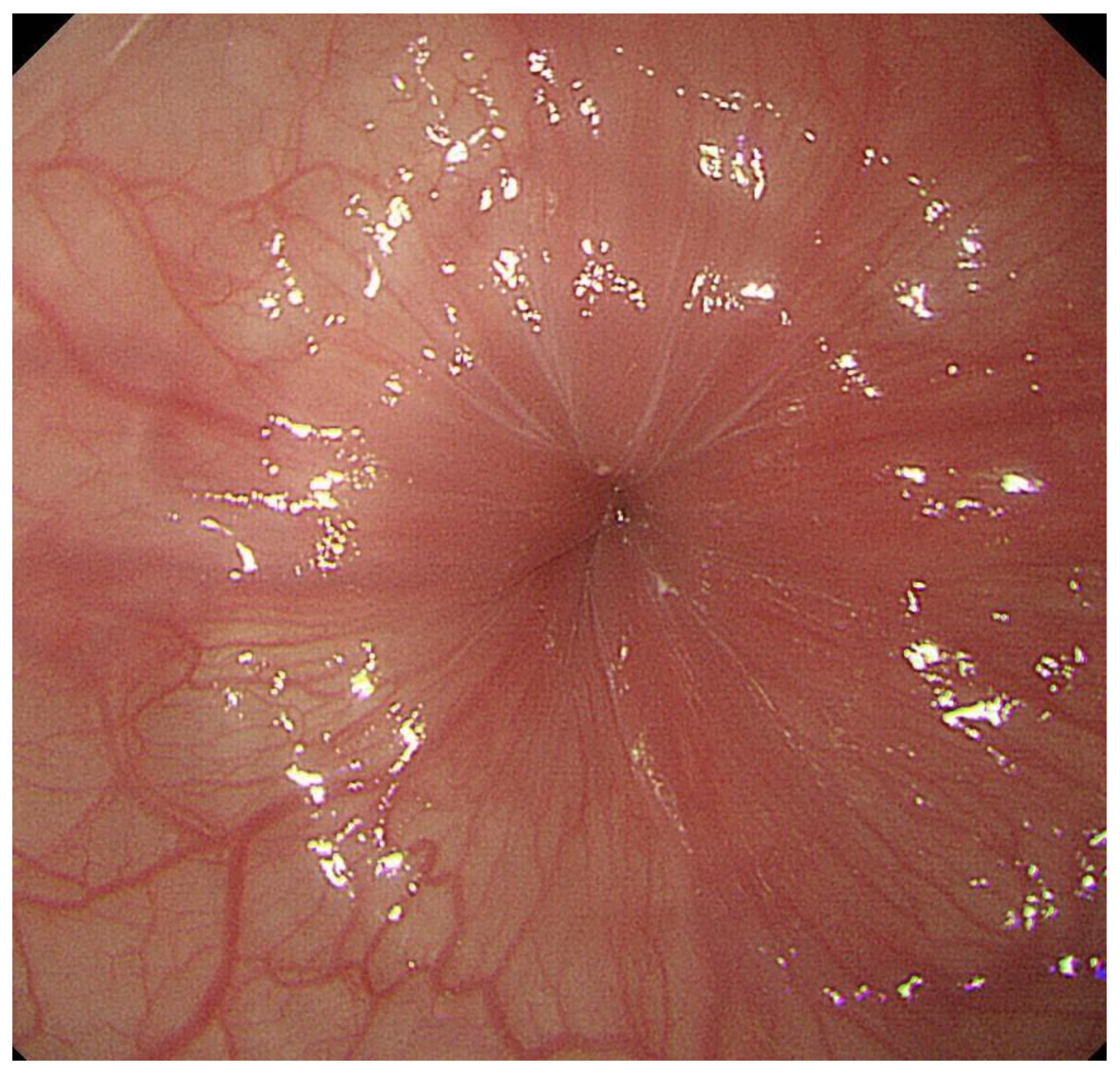 Diagnostics 13 00695 g001