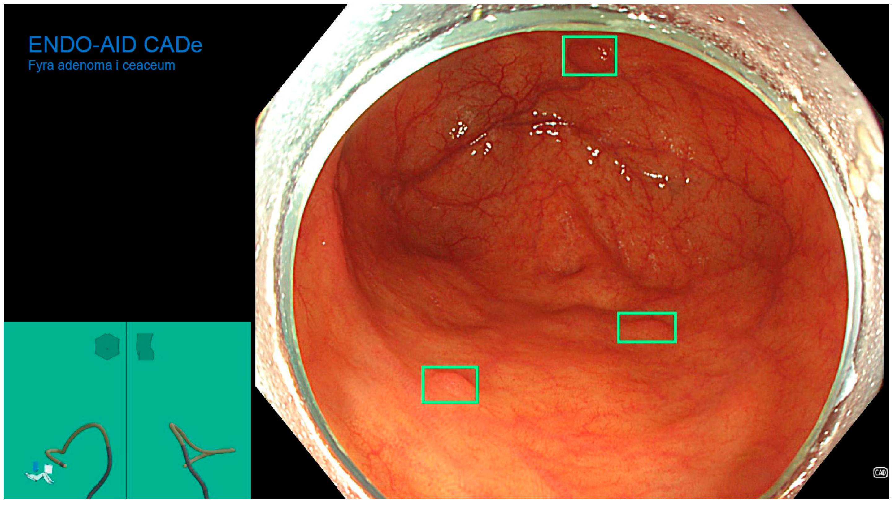 Diagnostics 13 00701 g003