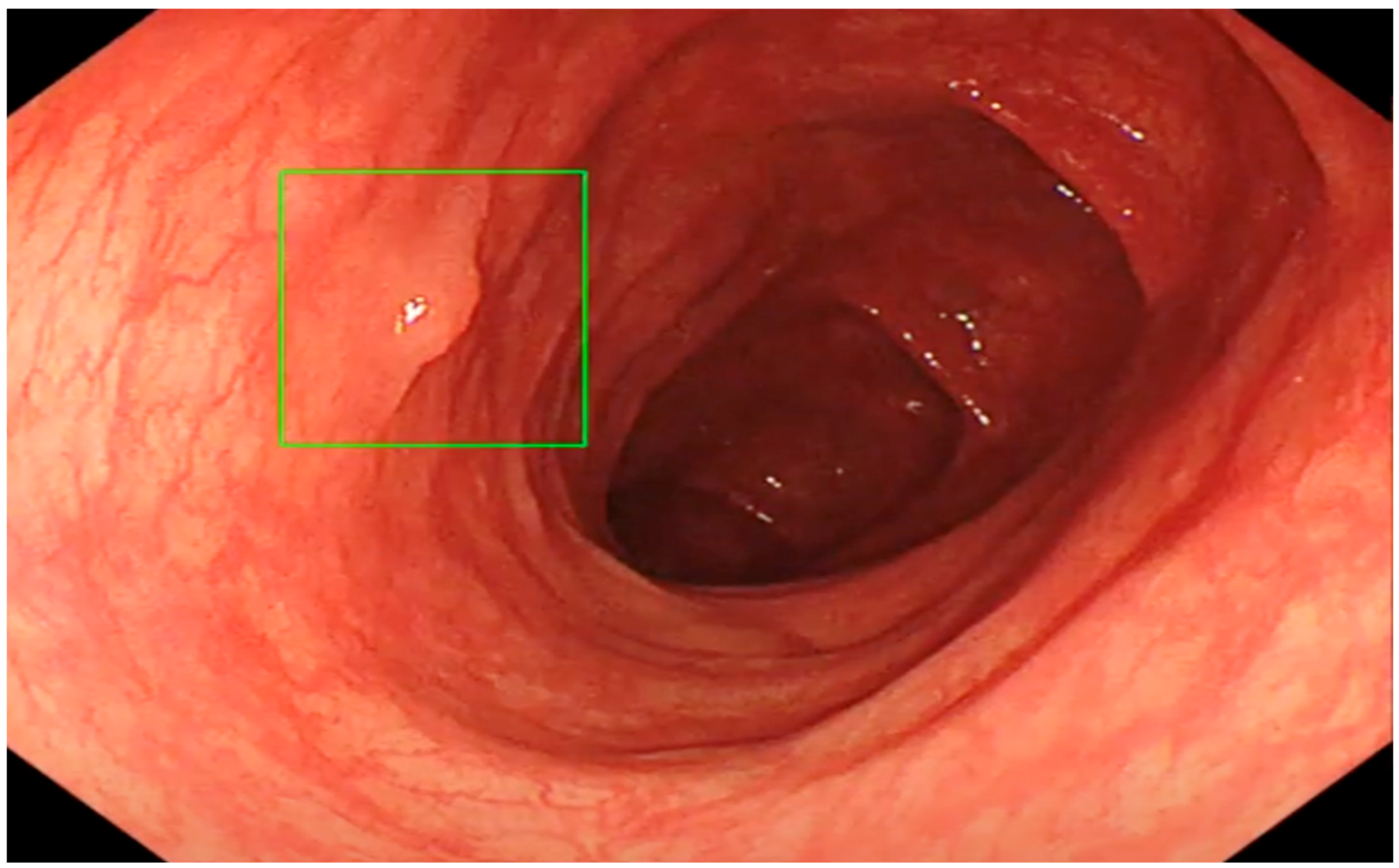 Diagnostics 13 00701 g004