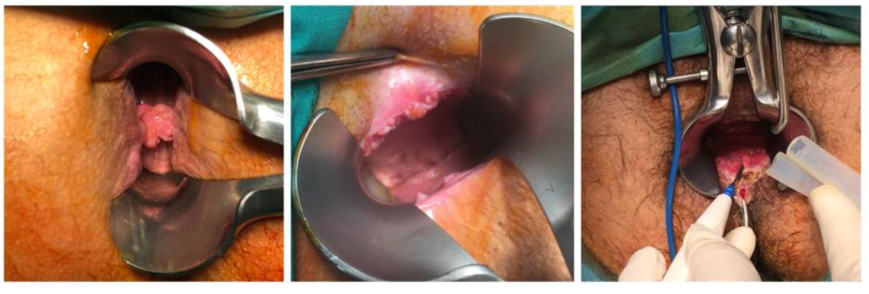 Diagnostics 13 00702 g005 Diagnostics 13 00702 g005