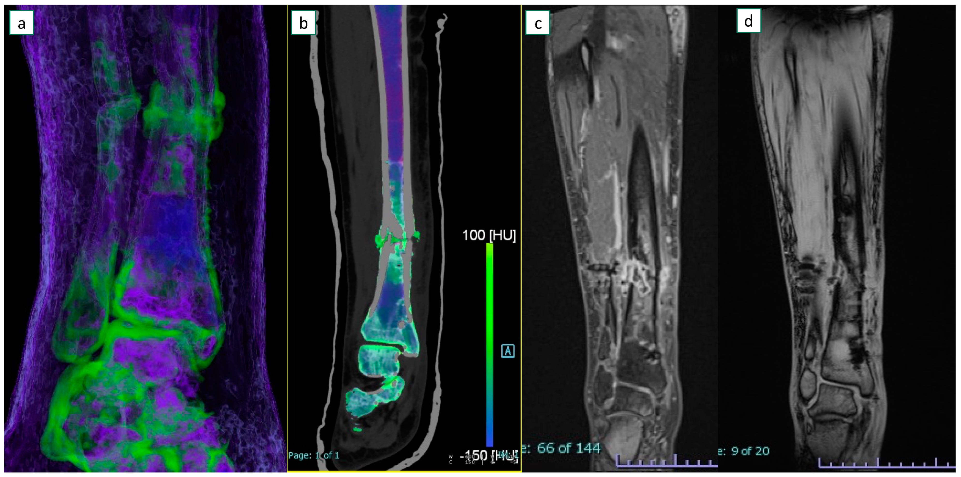 Diagnostics 13 00703 g004 550