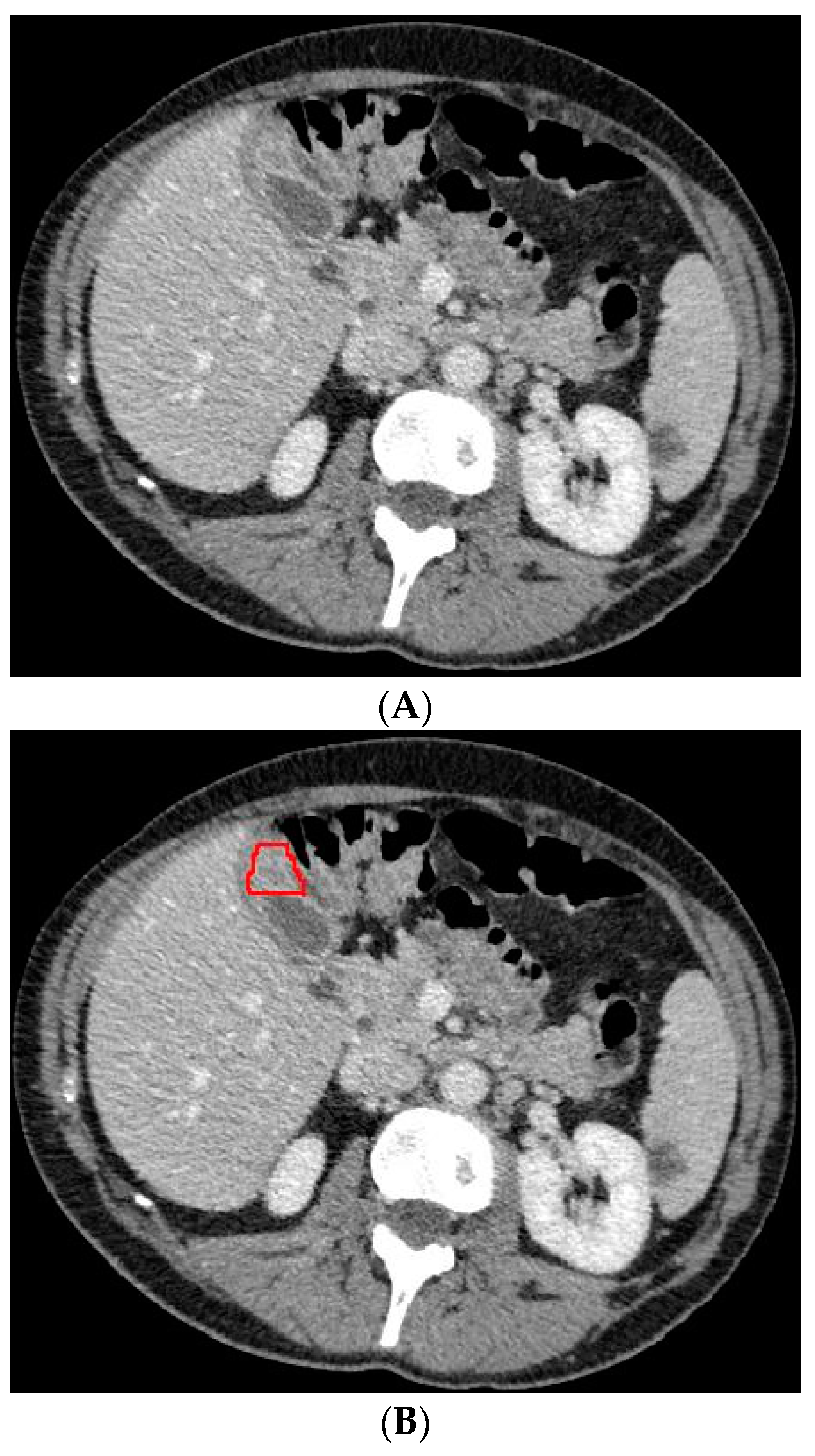 Diagnostics 13 00704 g003a 550