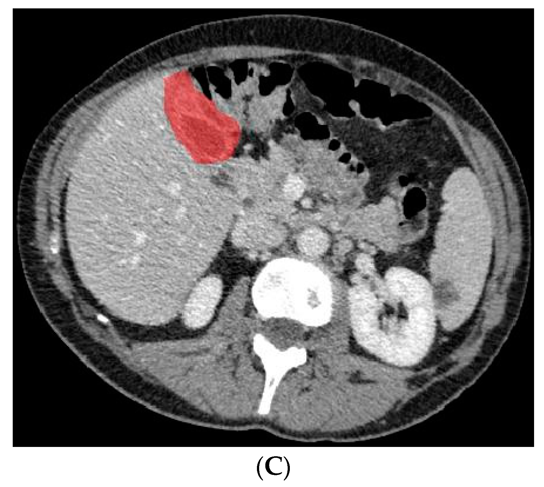 Diagnostics 13 00704 g003b 550