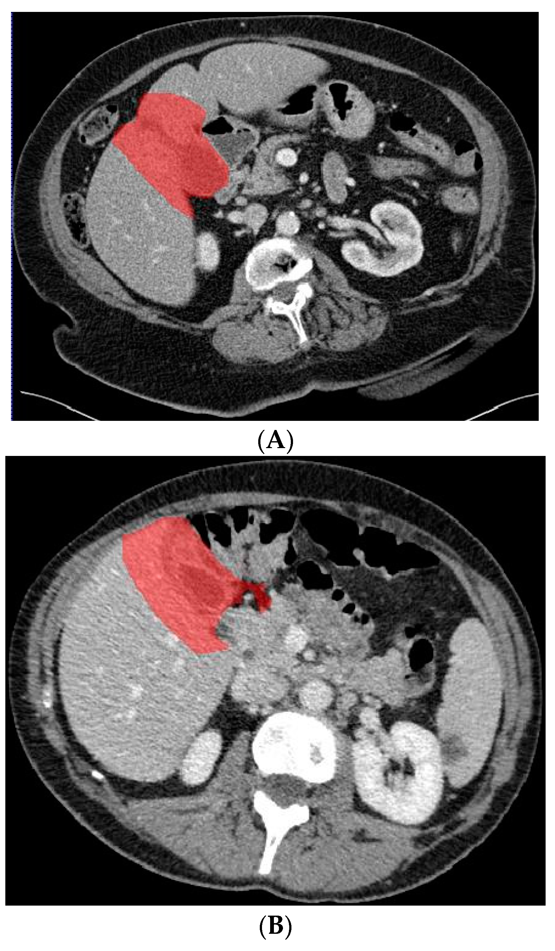 Diagnostics 13 00704 g004 550
