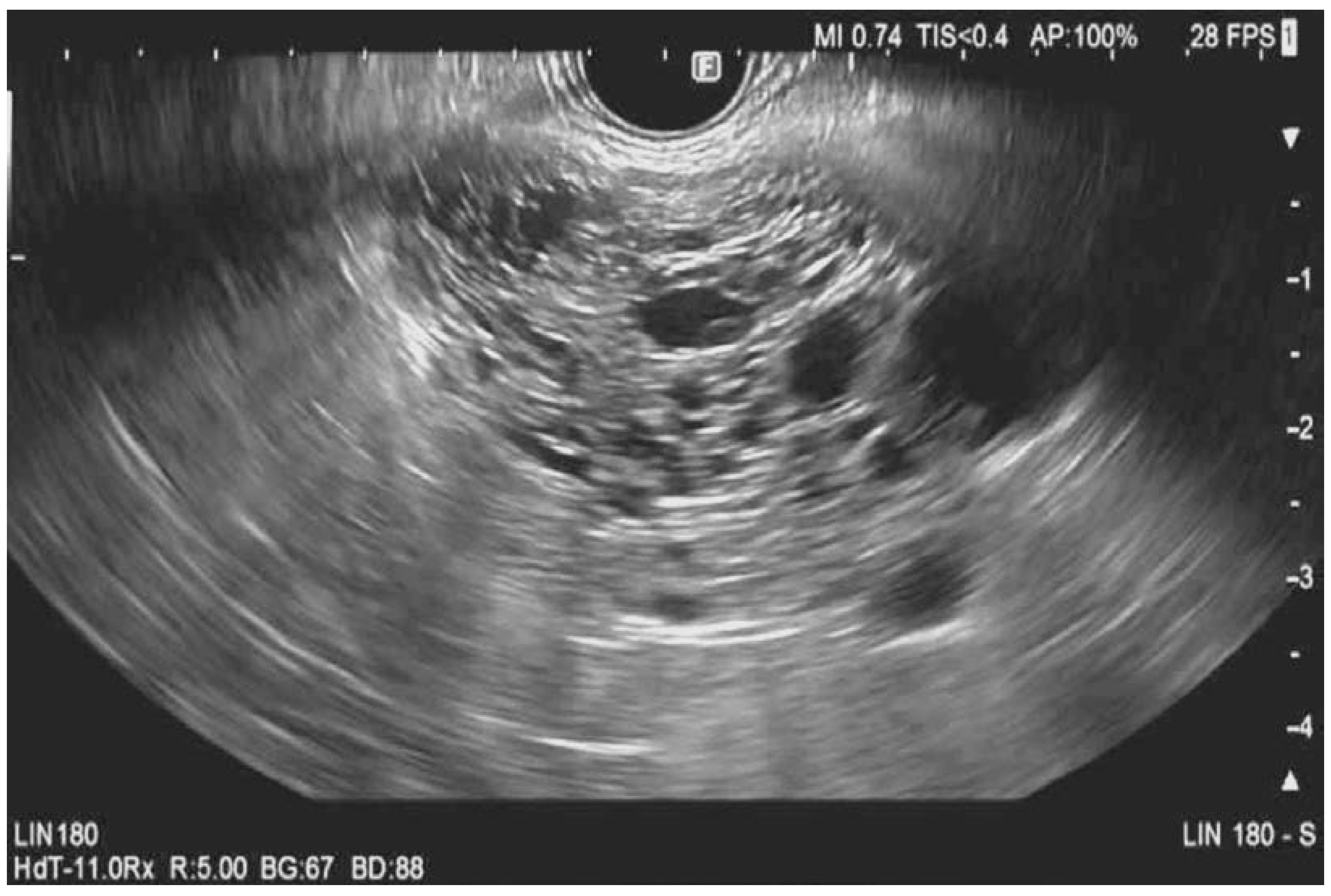 Diagnostics | Free Full-Text | Role of Endoscopic Ultrasound in