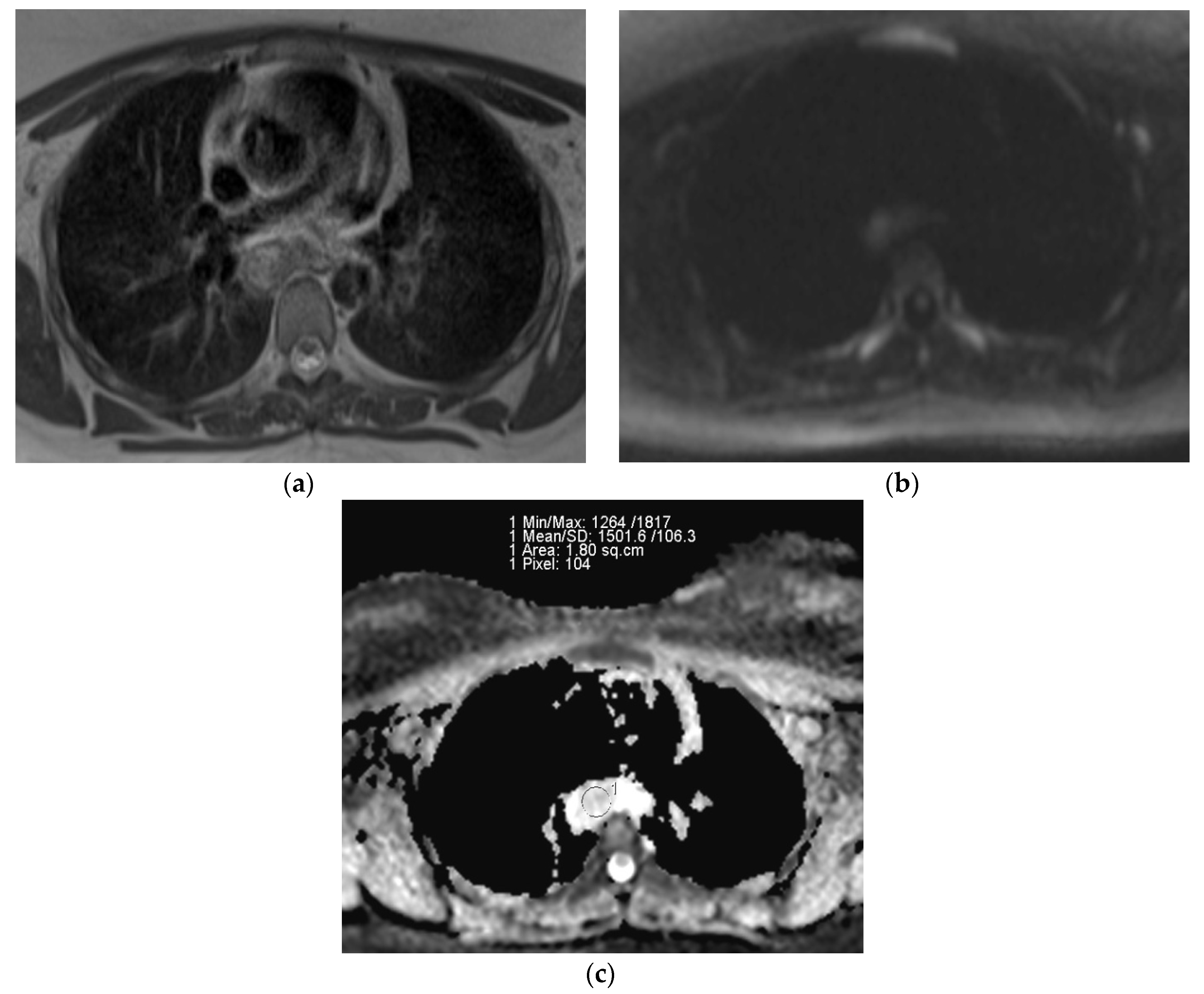 Diagnostics 13 00706 g003
