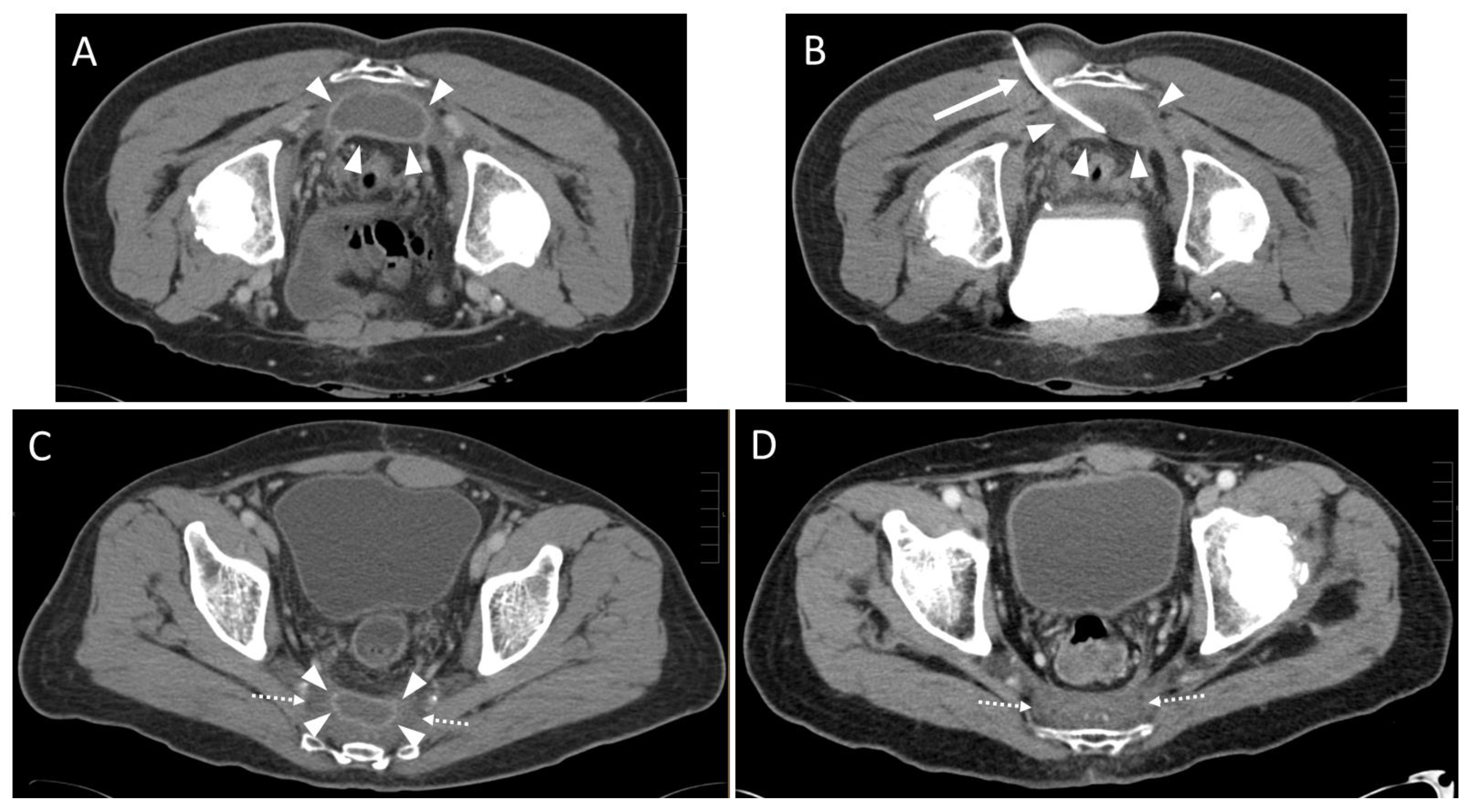 Diagnostics 13 00711 g003 550