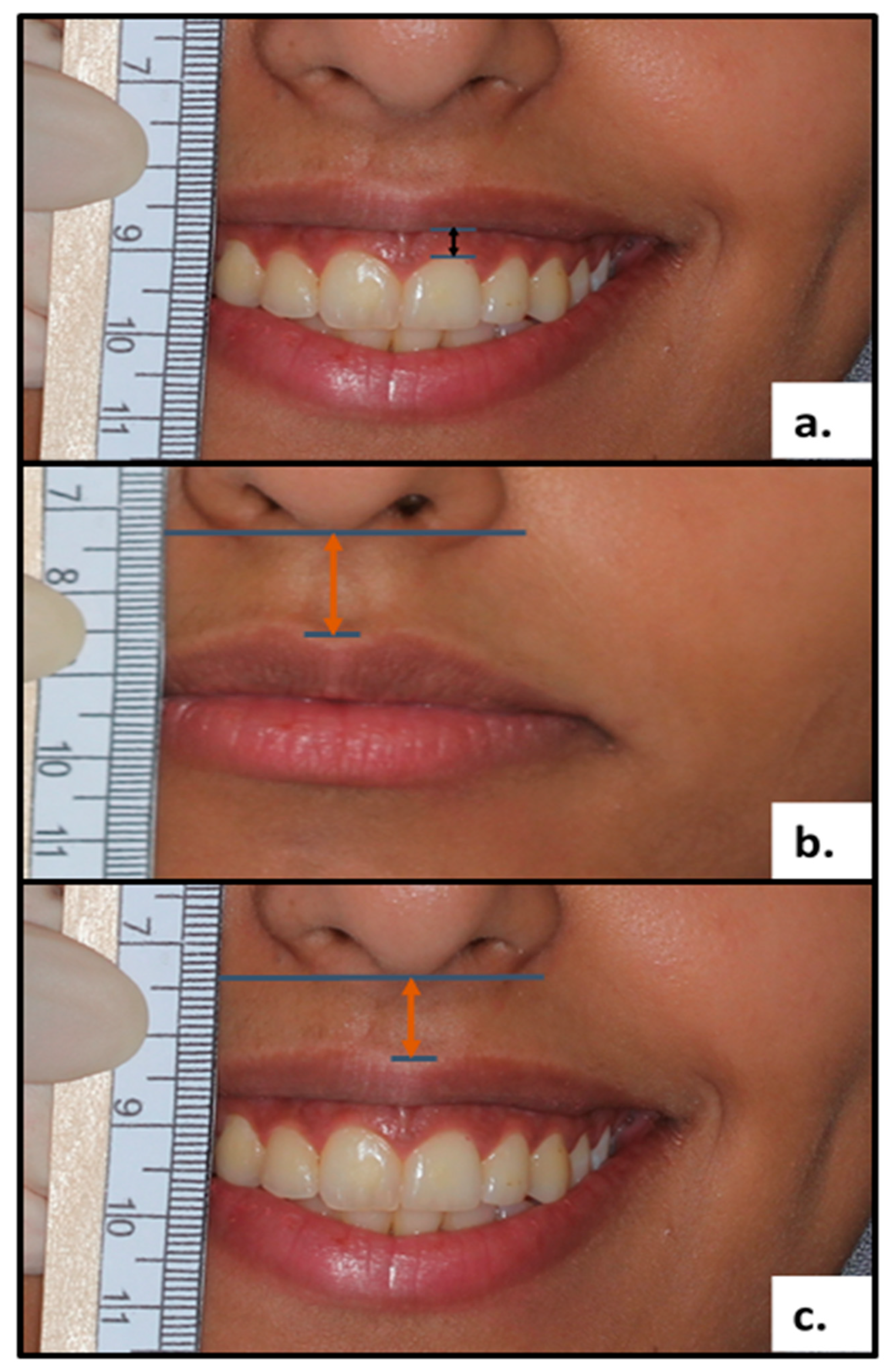 Diagnostics 13 00716 g001 550
