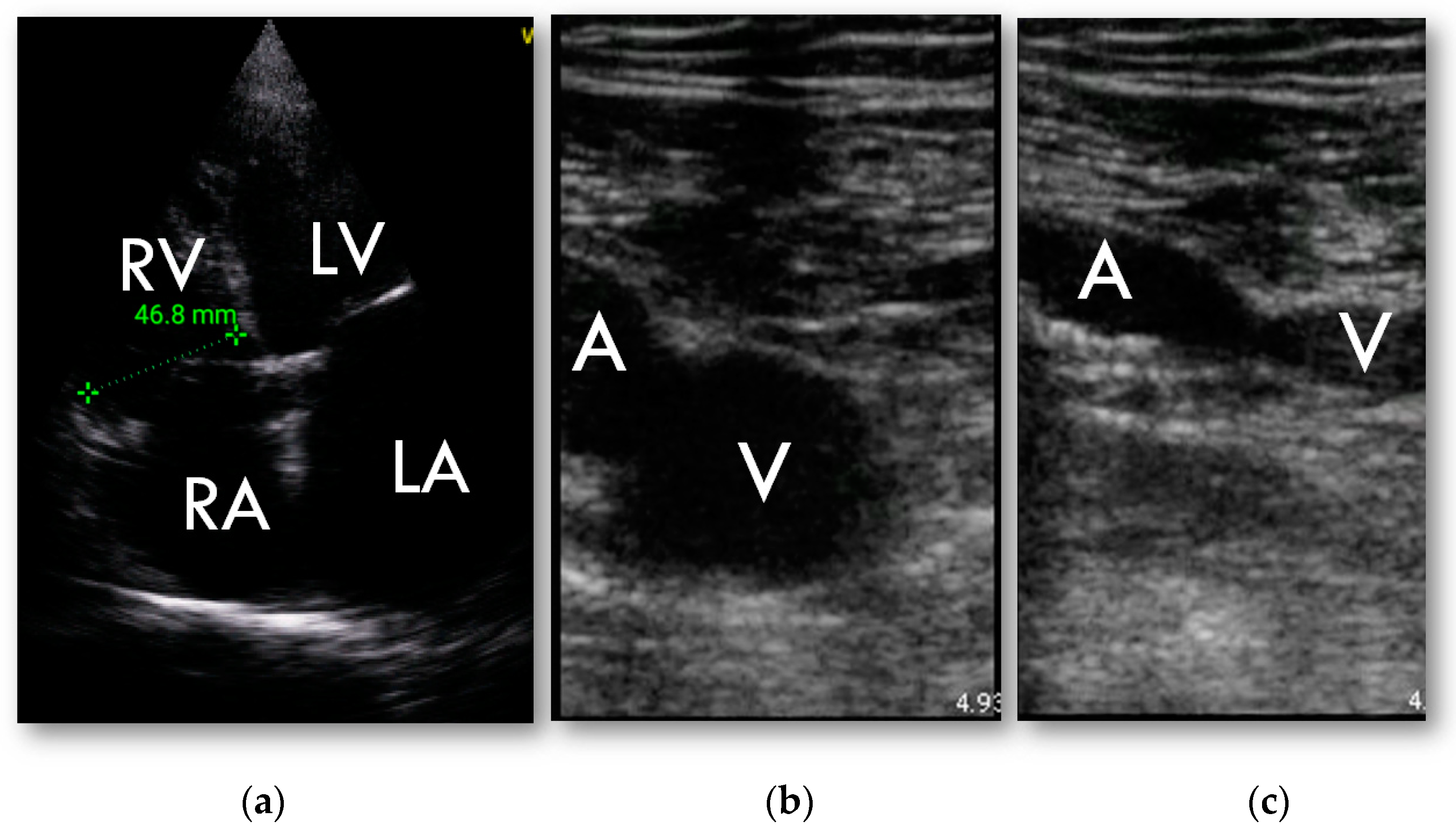 Diagnostics 13 00724 g004