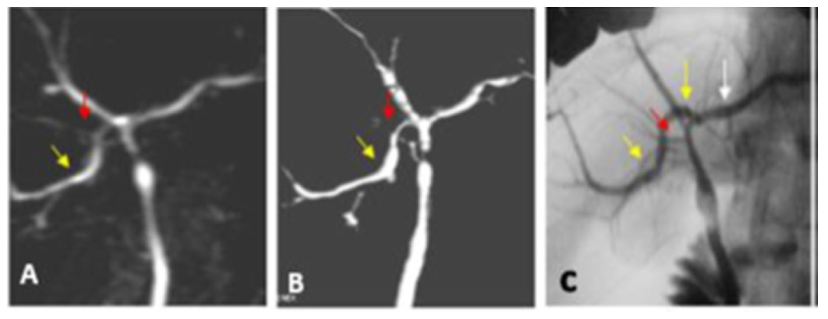 Diagnostics 13 00726 g005 Diagnostics 13 00726 g005