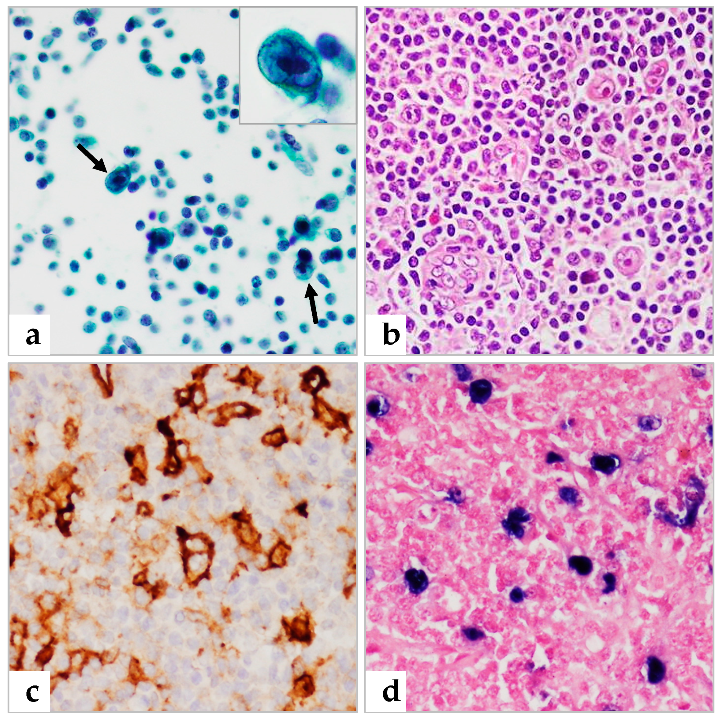 Diagnostics 13 00728 g004 Diagnostics 13 00728 g004