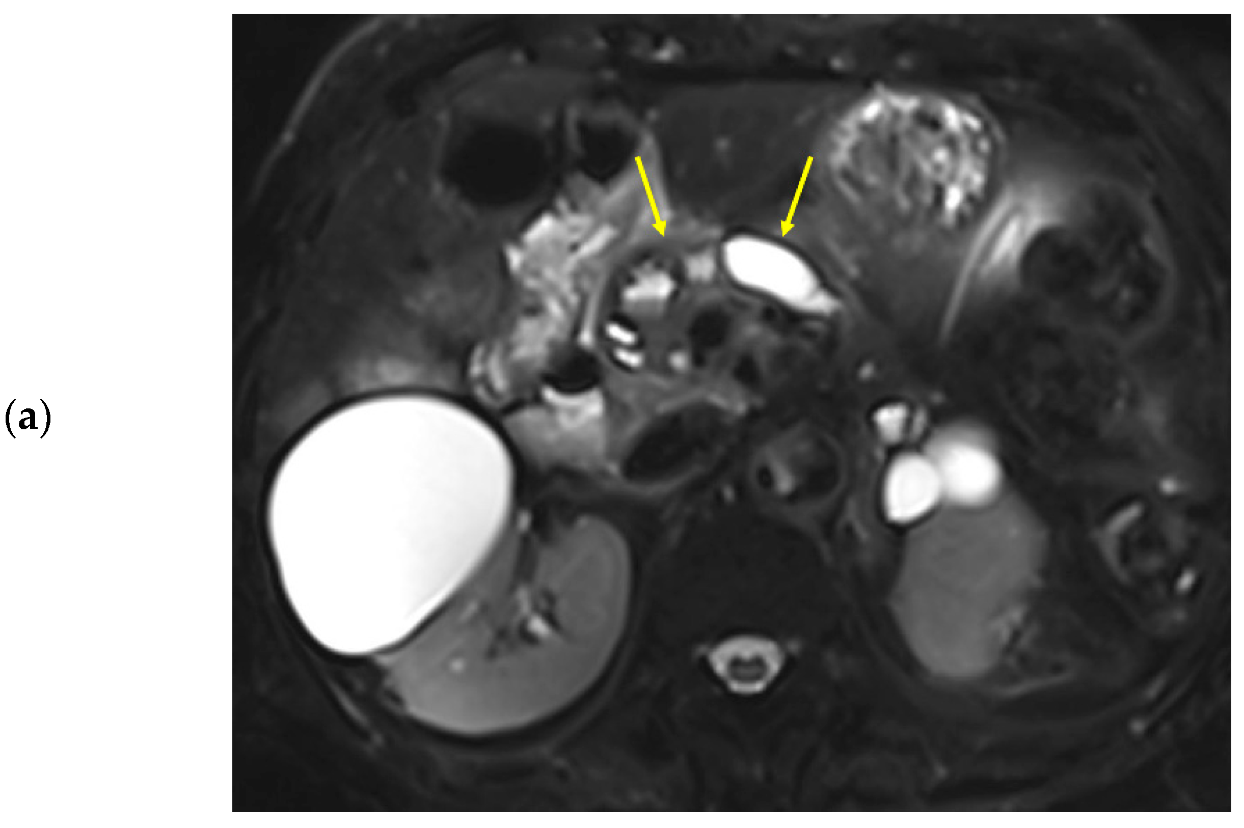 Diagnostics 13 00731 g003a Diagnostics 13 00731 g003a
