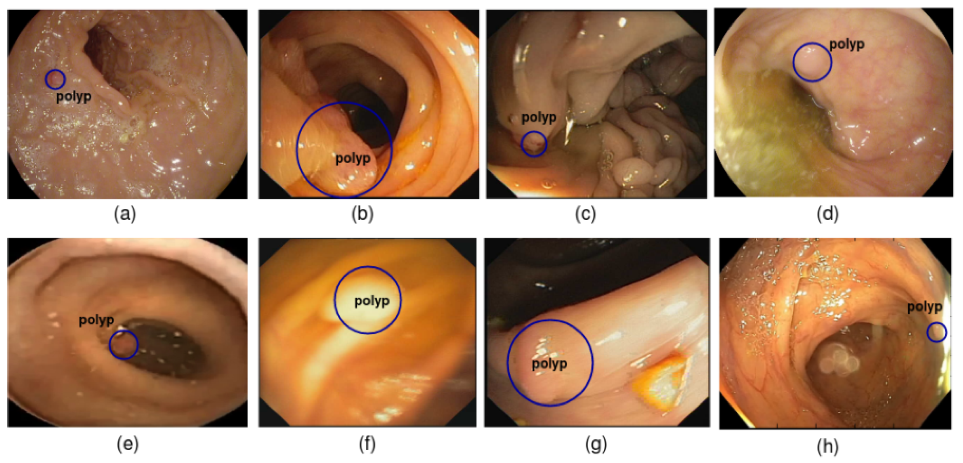 Diagnostics 13 00733 g001 550