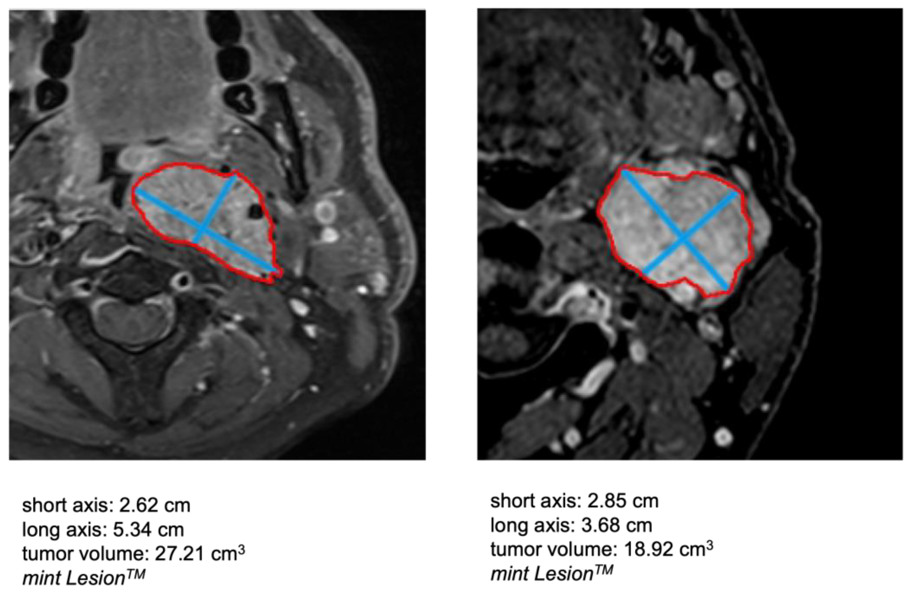 Diagnostics 13 00744 g001