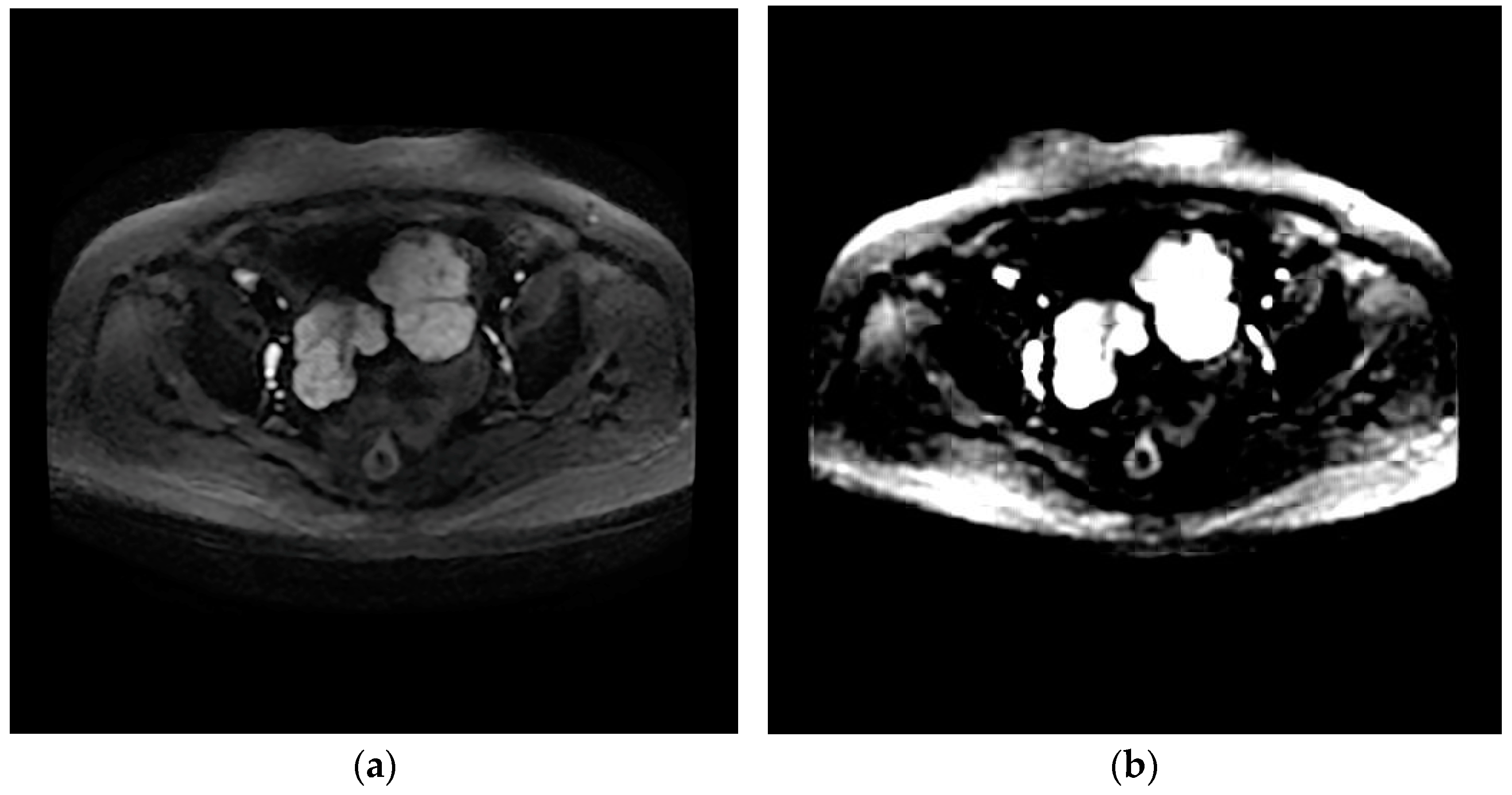 Diagnostics 13 00748 g004