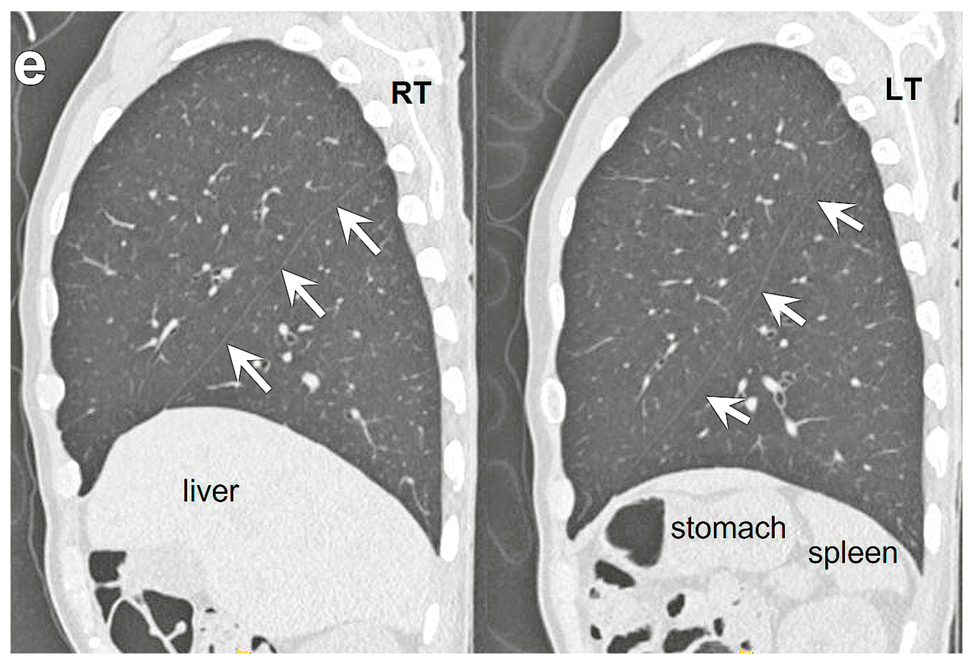 Diagnostics 13 00751 g001b 550