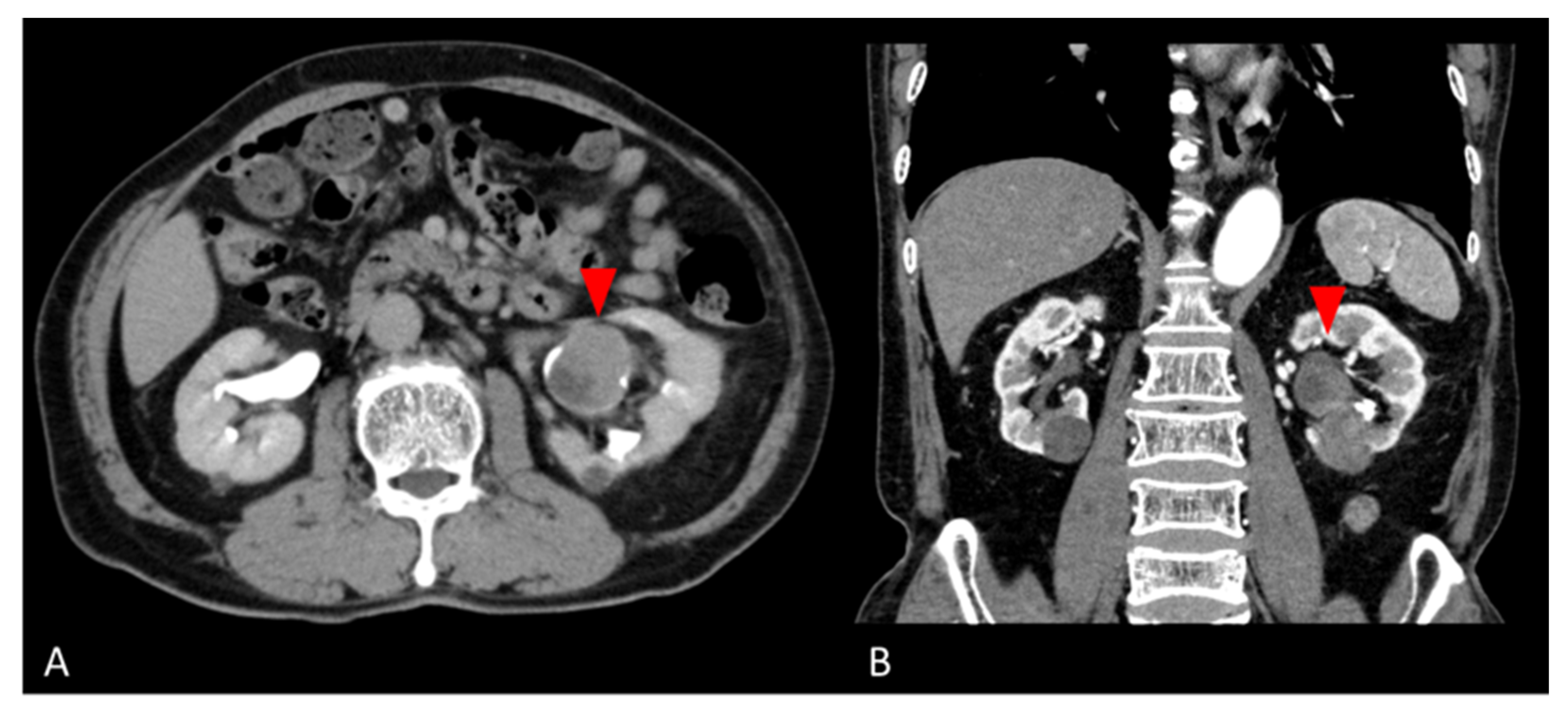 Diagnostics 13 00752 g001