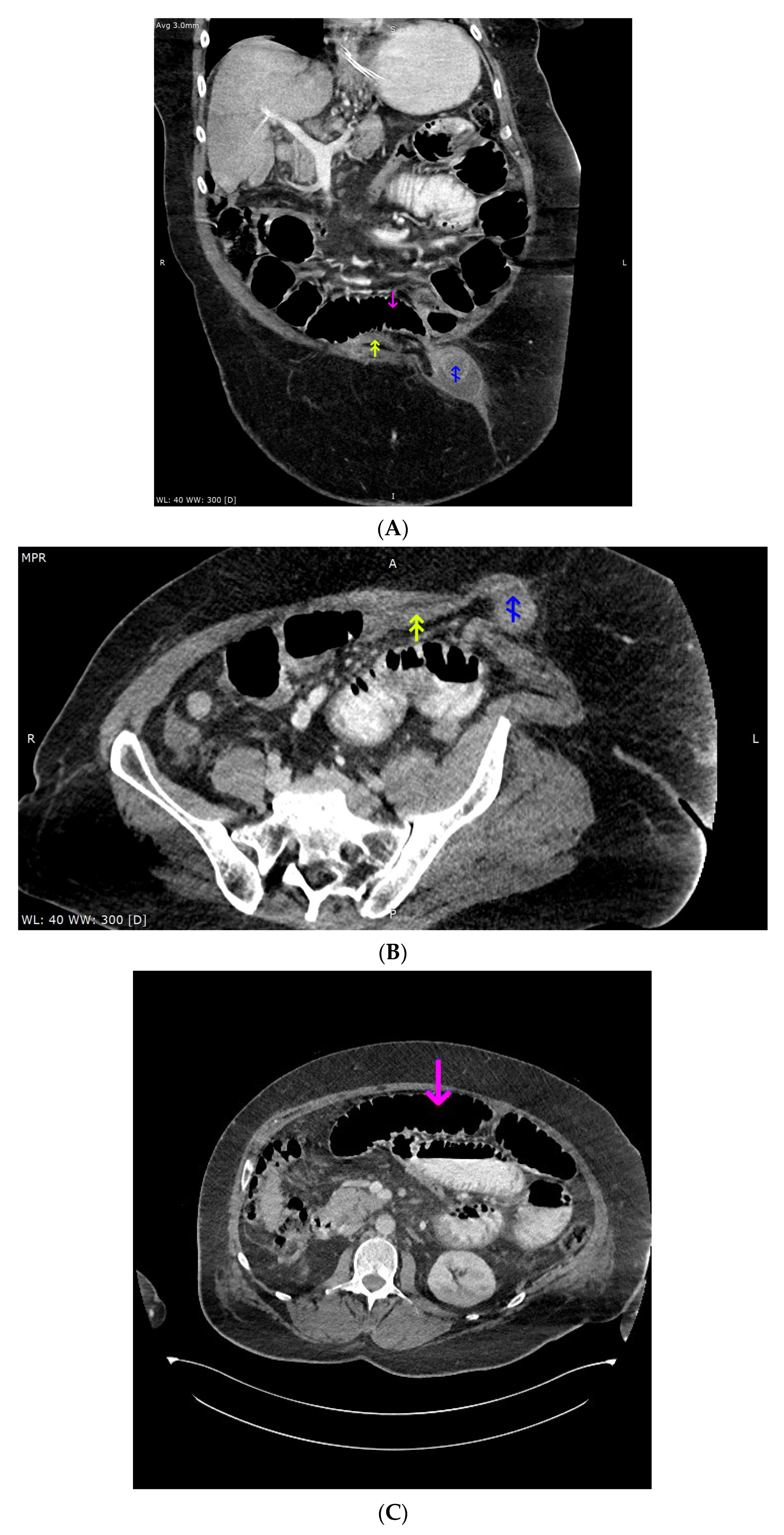 Diagnostics 13 00753 g002