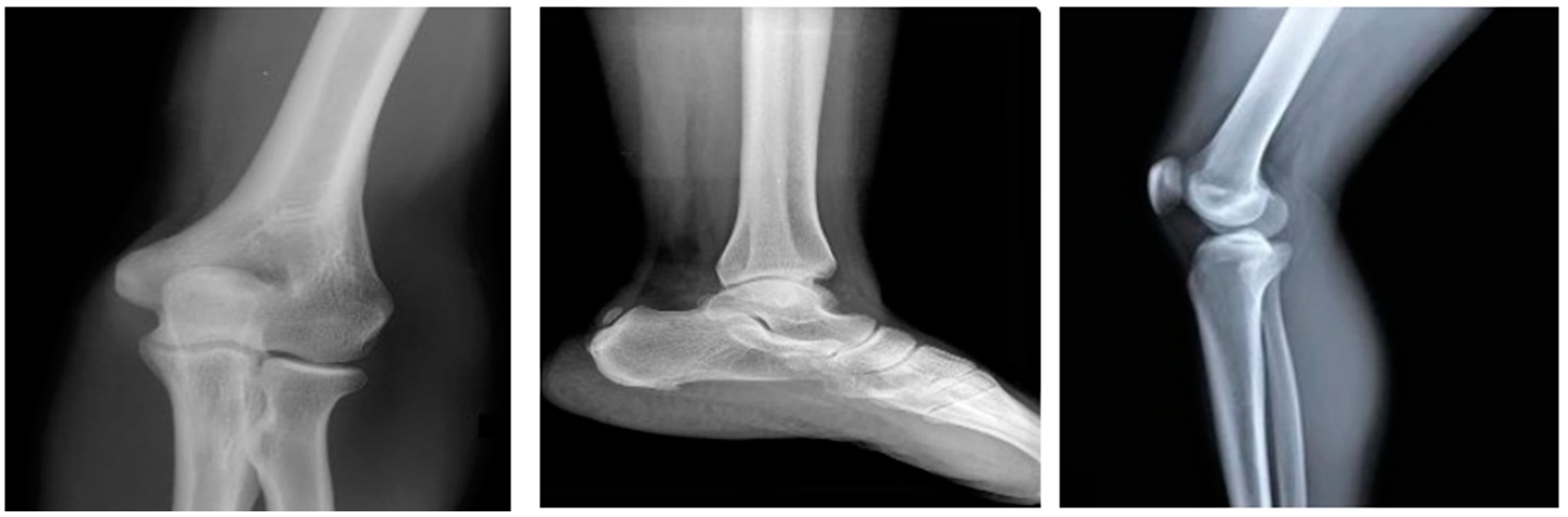 Diagnostics 13 00757 g002 Diagnostics 13 00757 g002