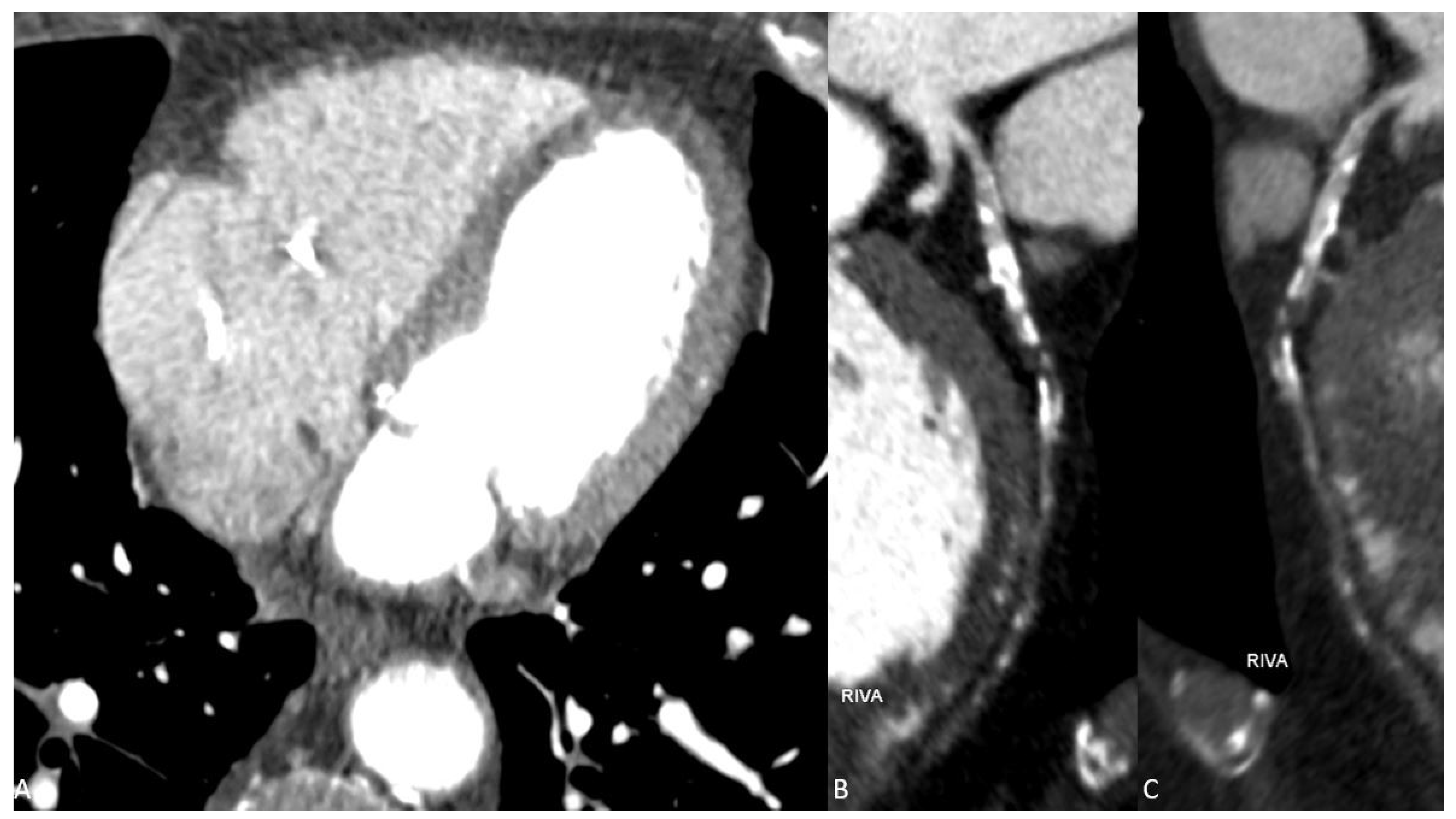 Diagnostics 13 00761 g001
