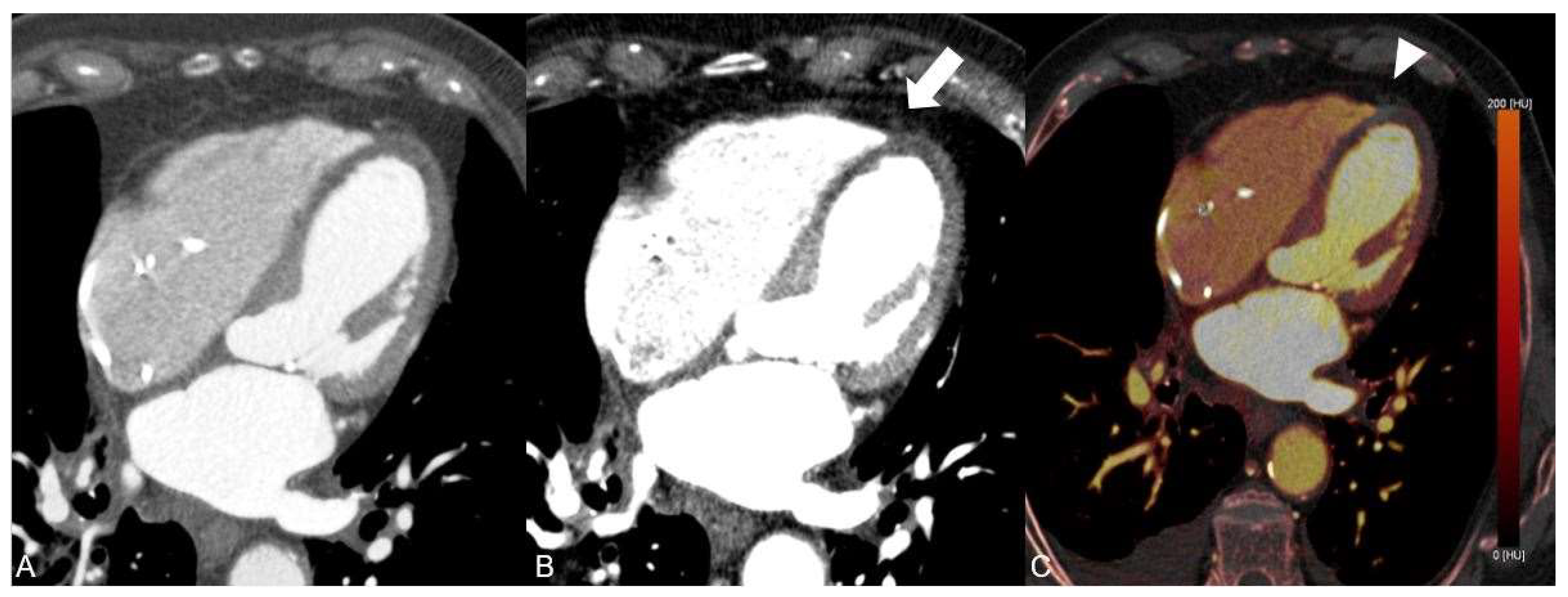 Diagnostics 13 00761 g002